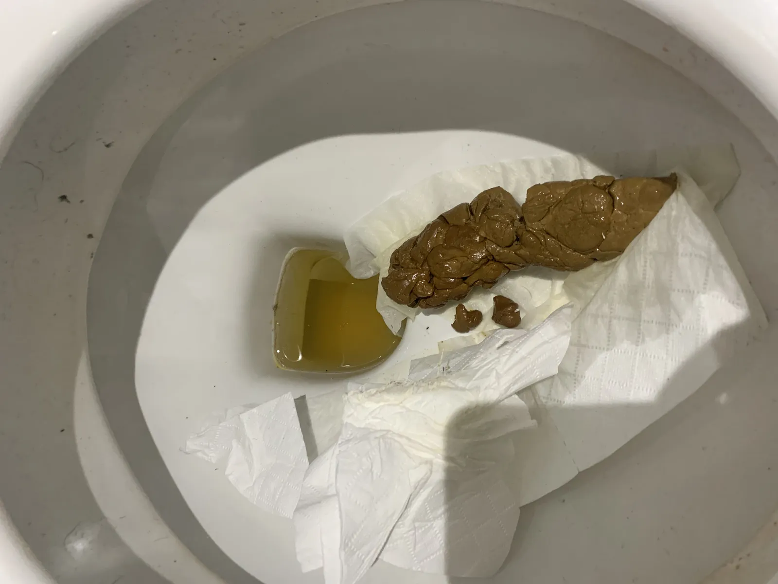 Check my poo, rate my poo. Library of Human Poops, Shits, and Feces Images.