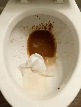 really watery diarrhea