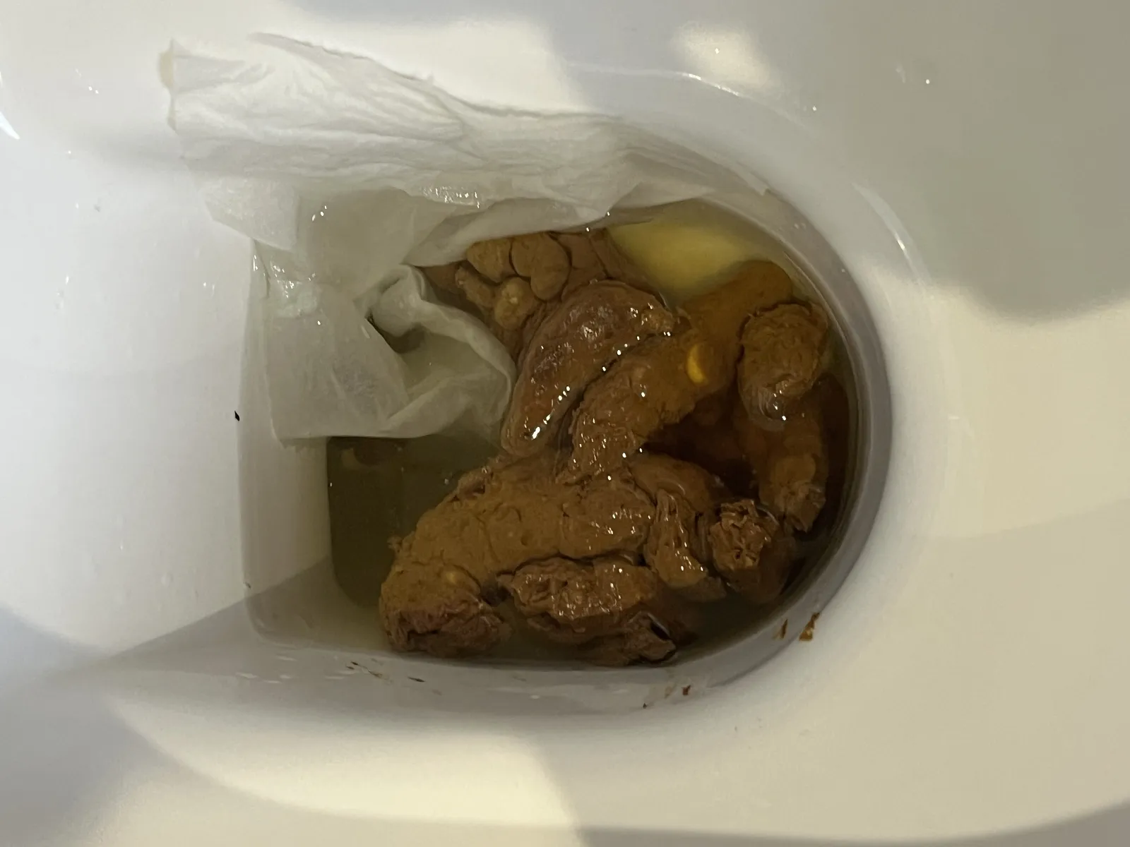 Check my poo, rate my poo. Library of Human Poops, Shits, and Feces Images.