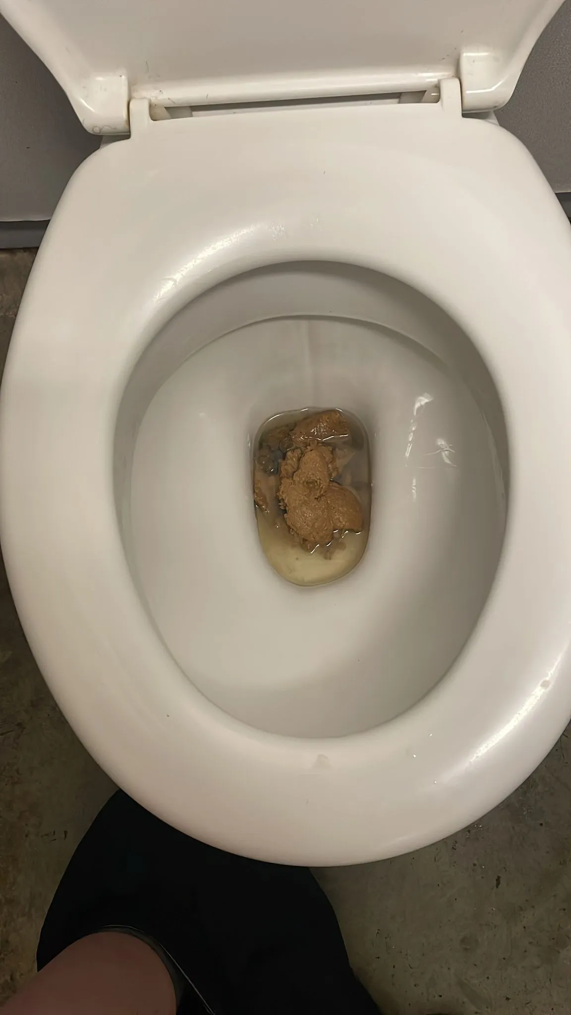 Football poo