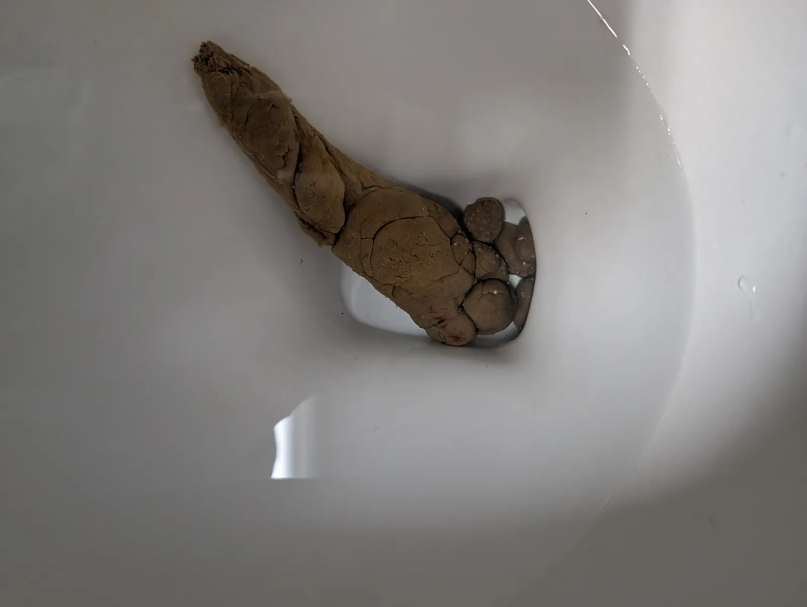 The Foot poop