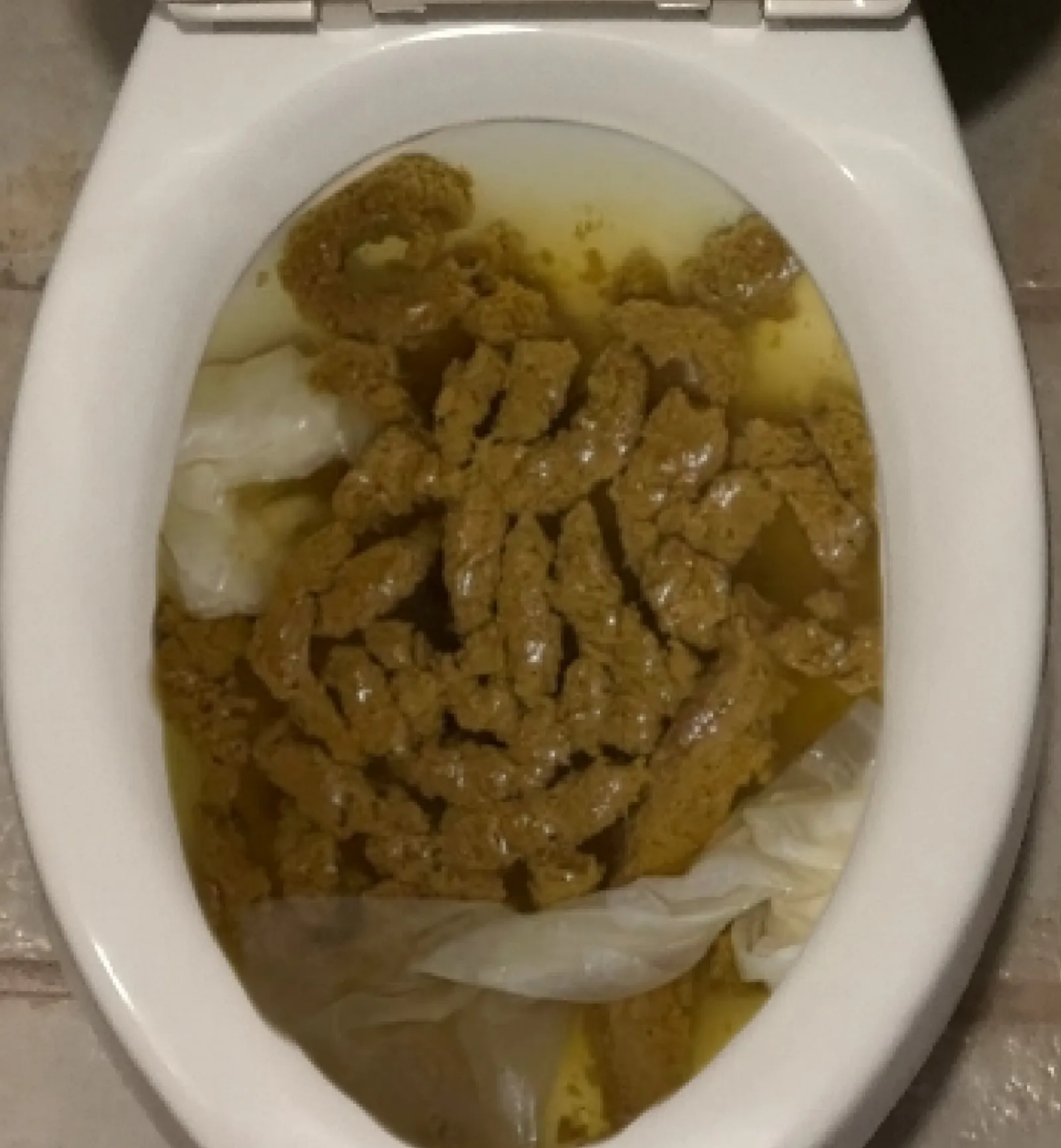 A mi novia le dolía el estomago