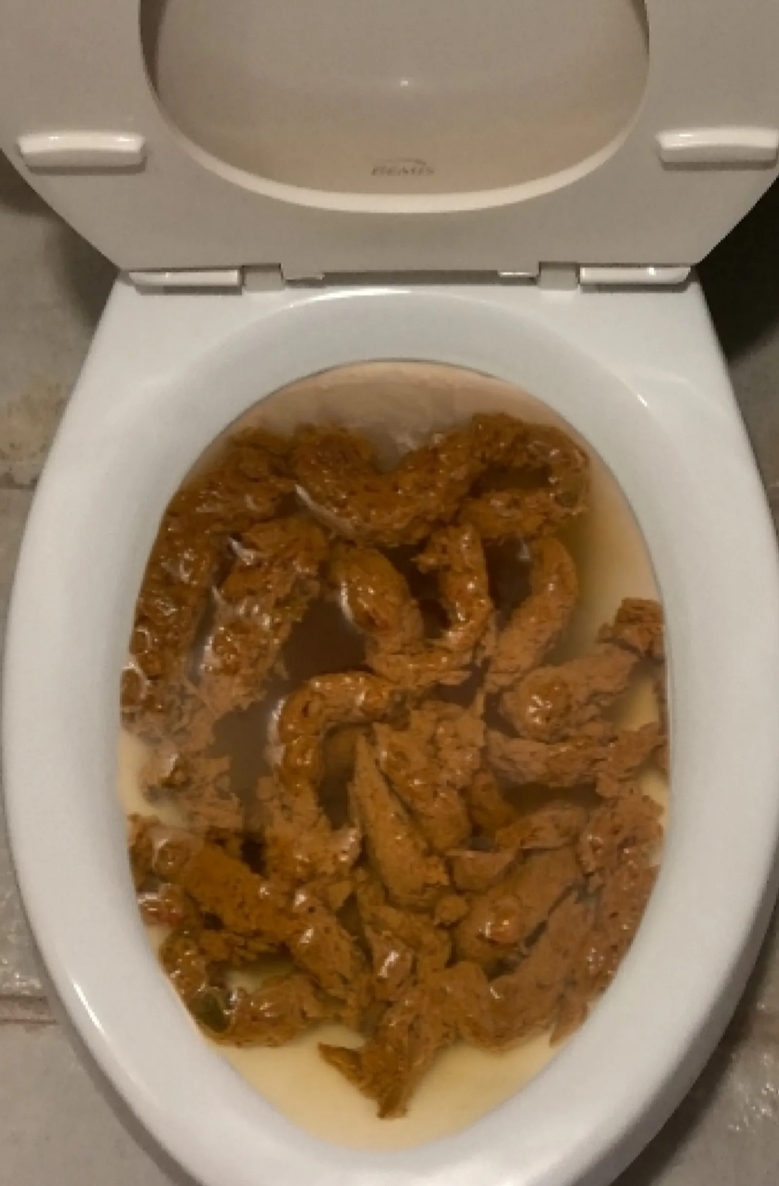 Una caca más de mi novia