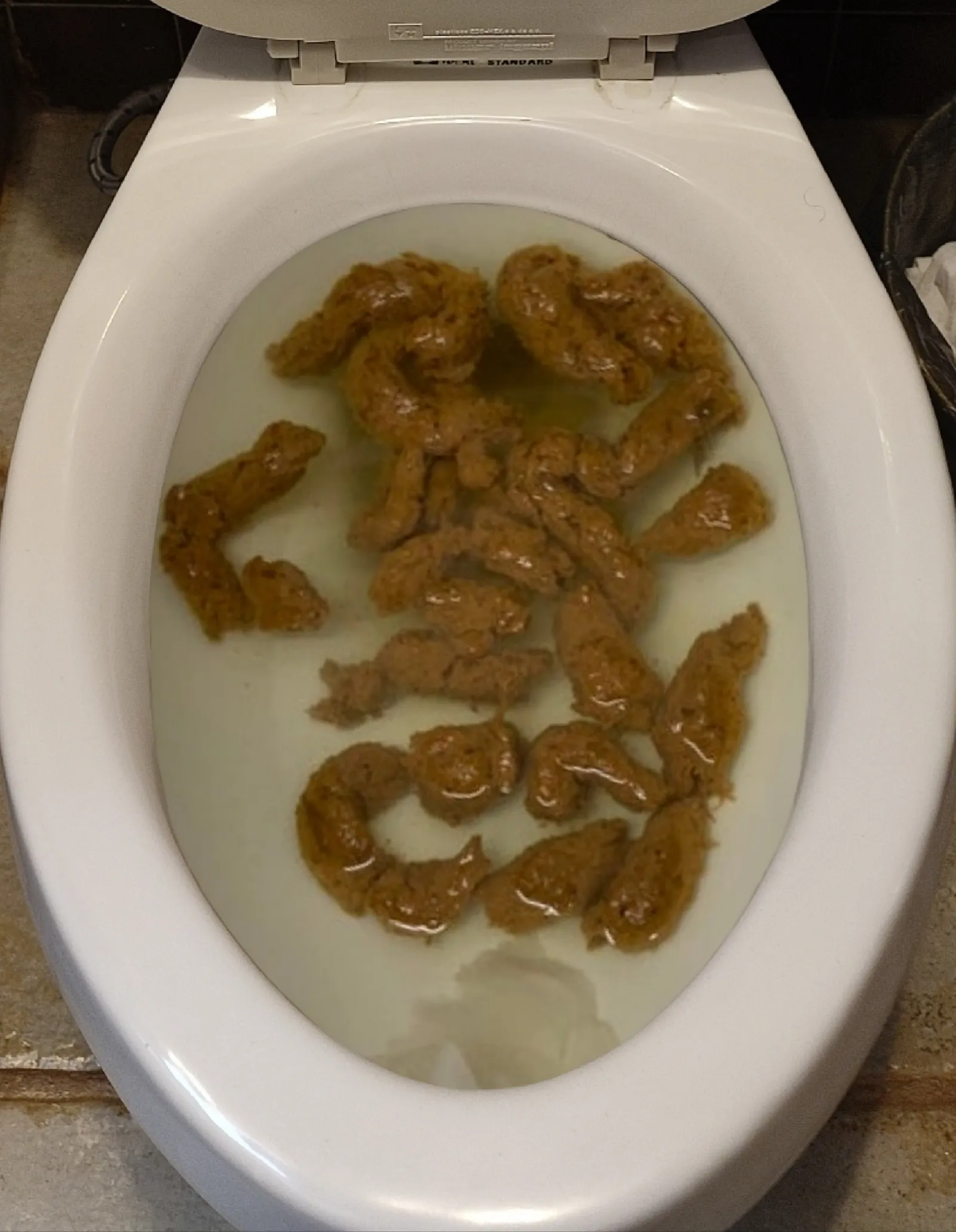 Mi novia hoy no pudo hacer bien popó