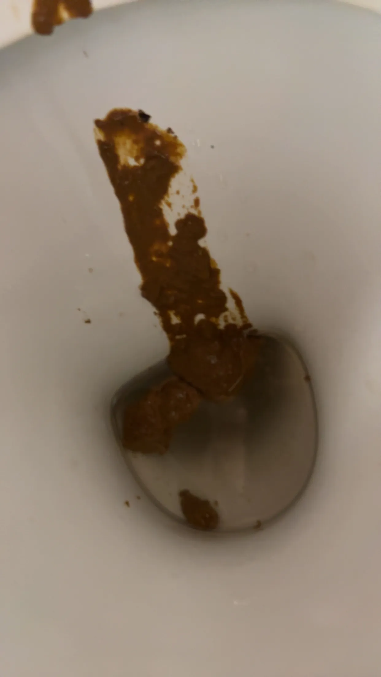 Poop