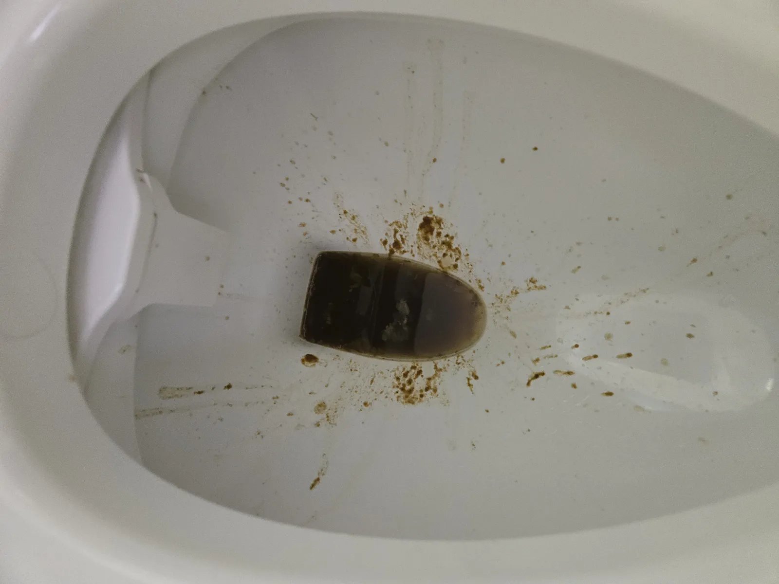 Diarrhea