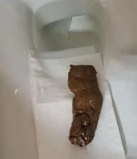 Hard turd