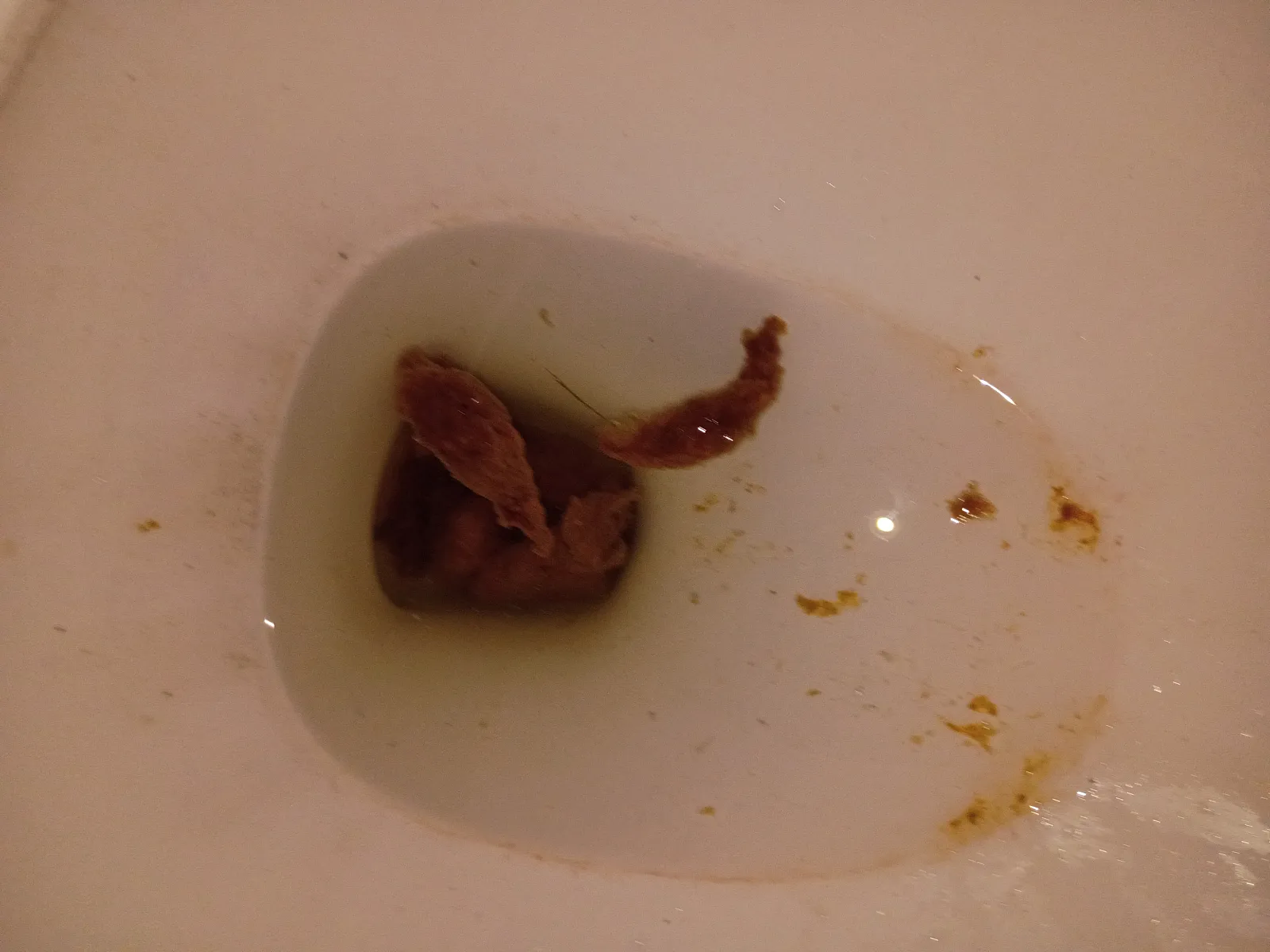 Ibs enema poo