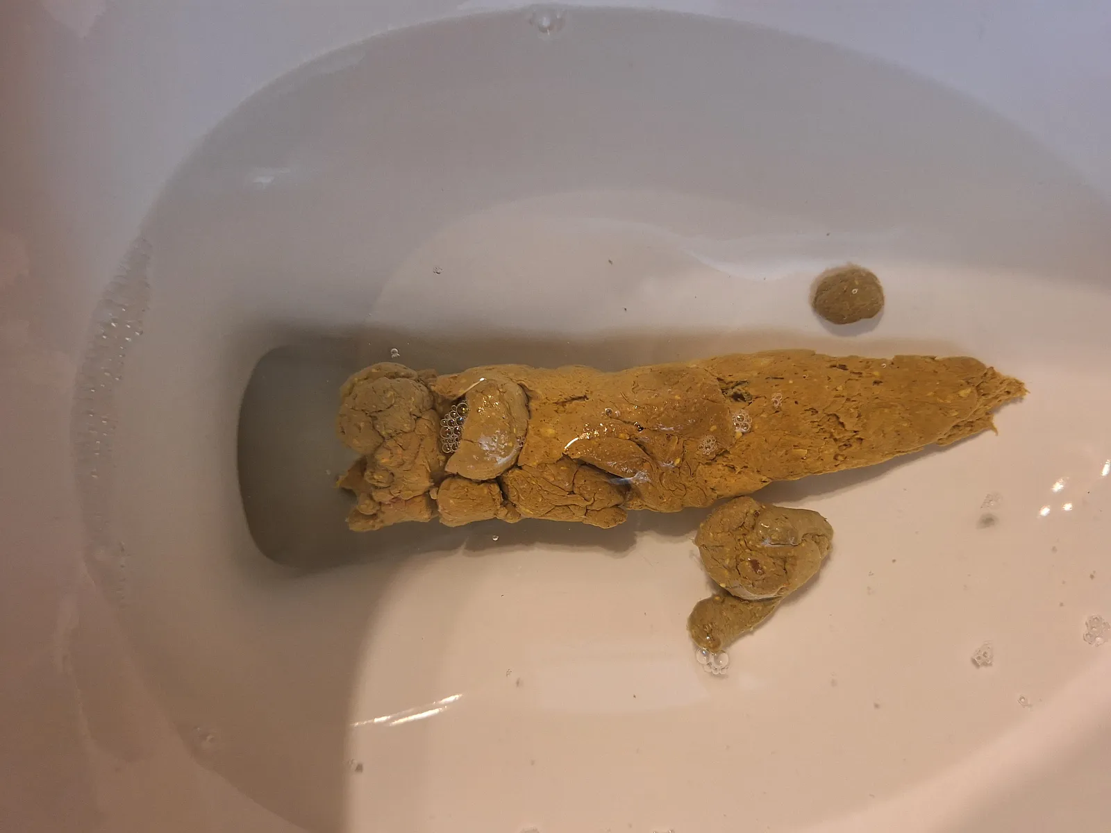Thick poop
