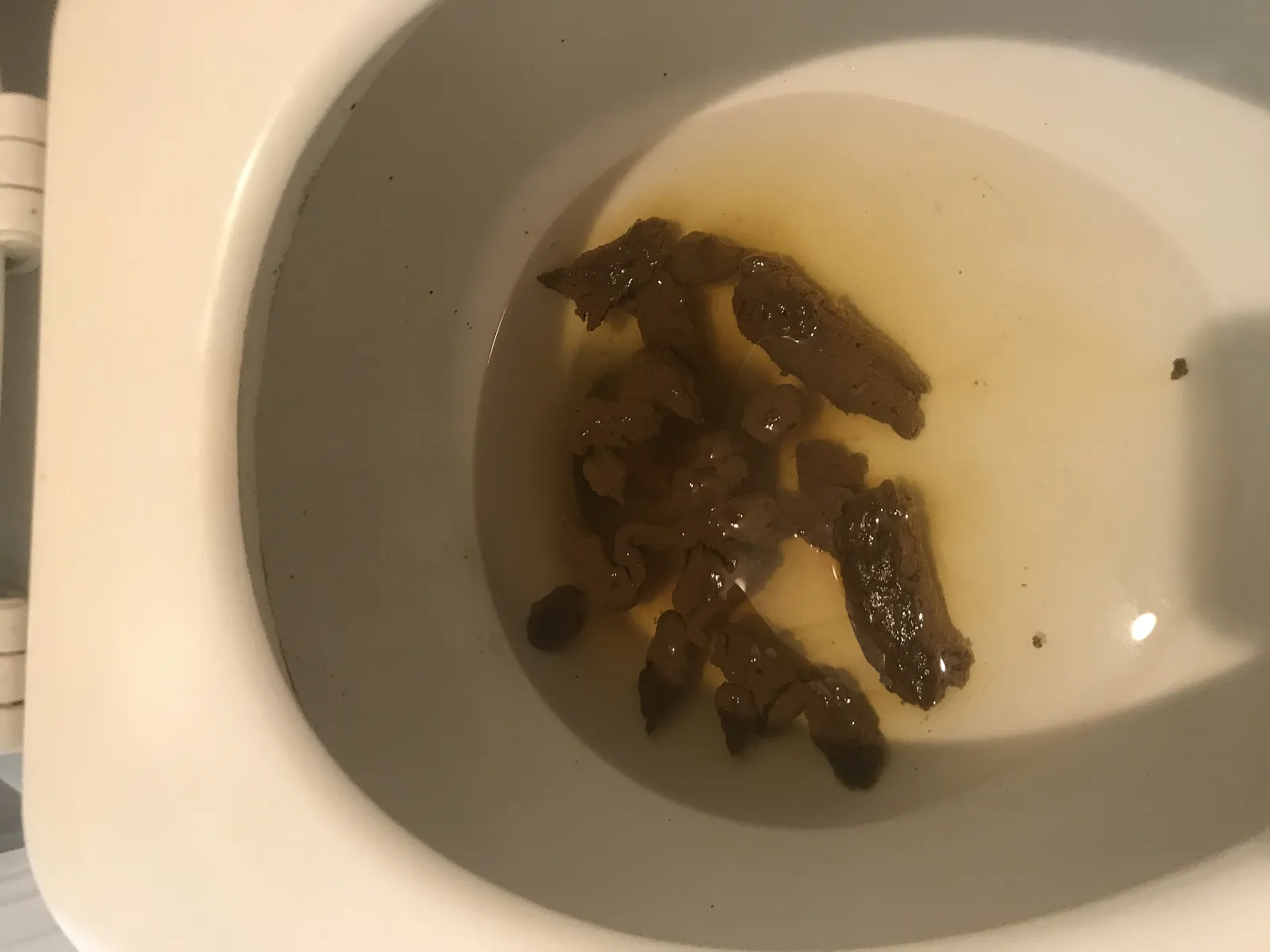 poop