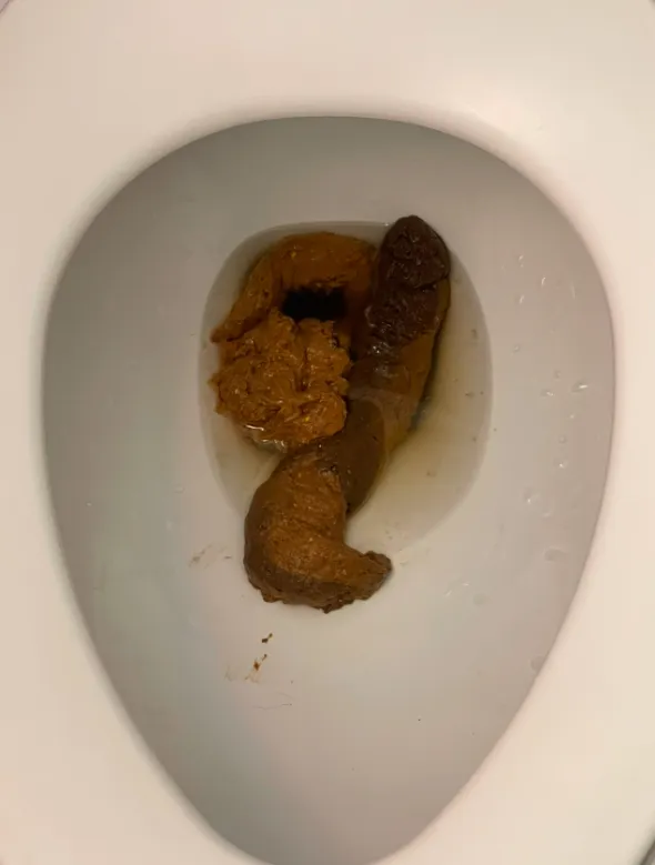 My Shit