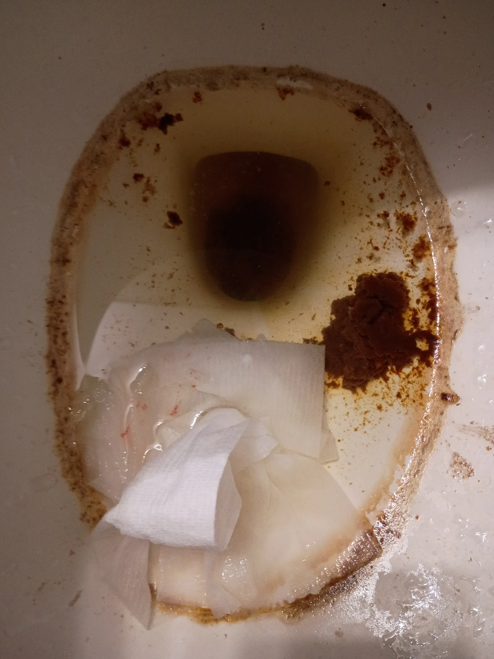 Poop Explotion Twisted Tea Explosion — Poop Photo from Houston, United States | CheckMyPoo