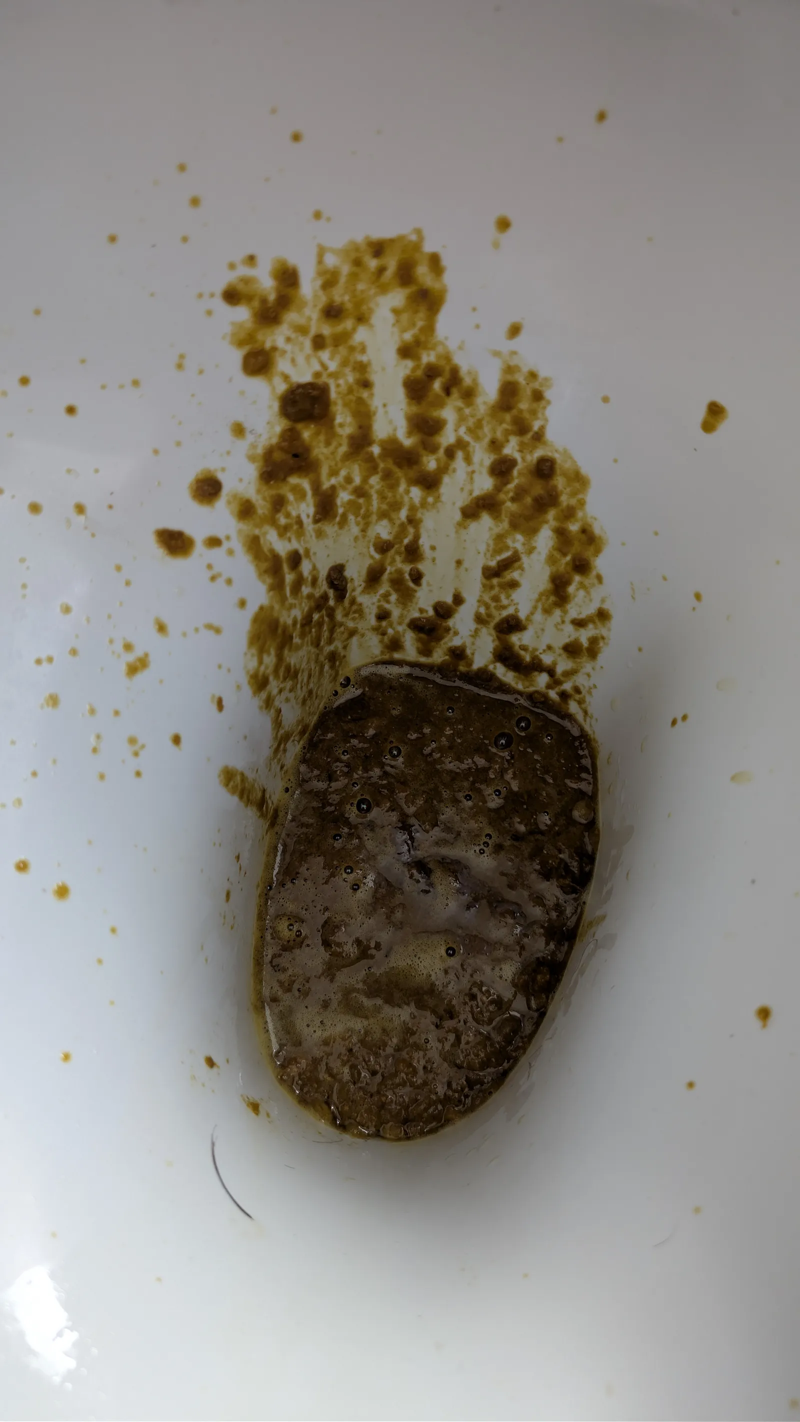 Anal Lava