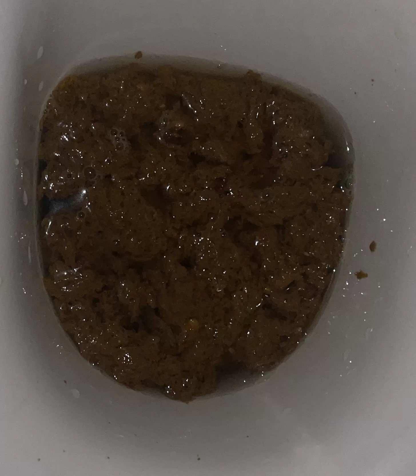 IBS… is this normal?