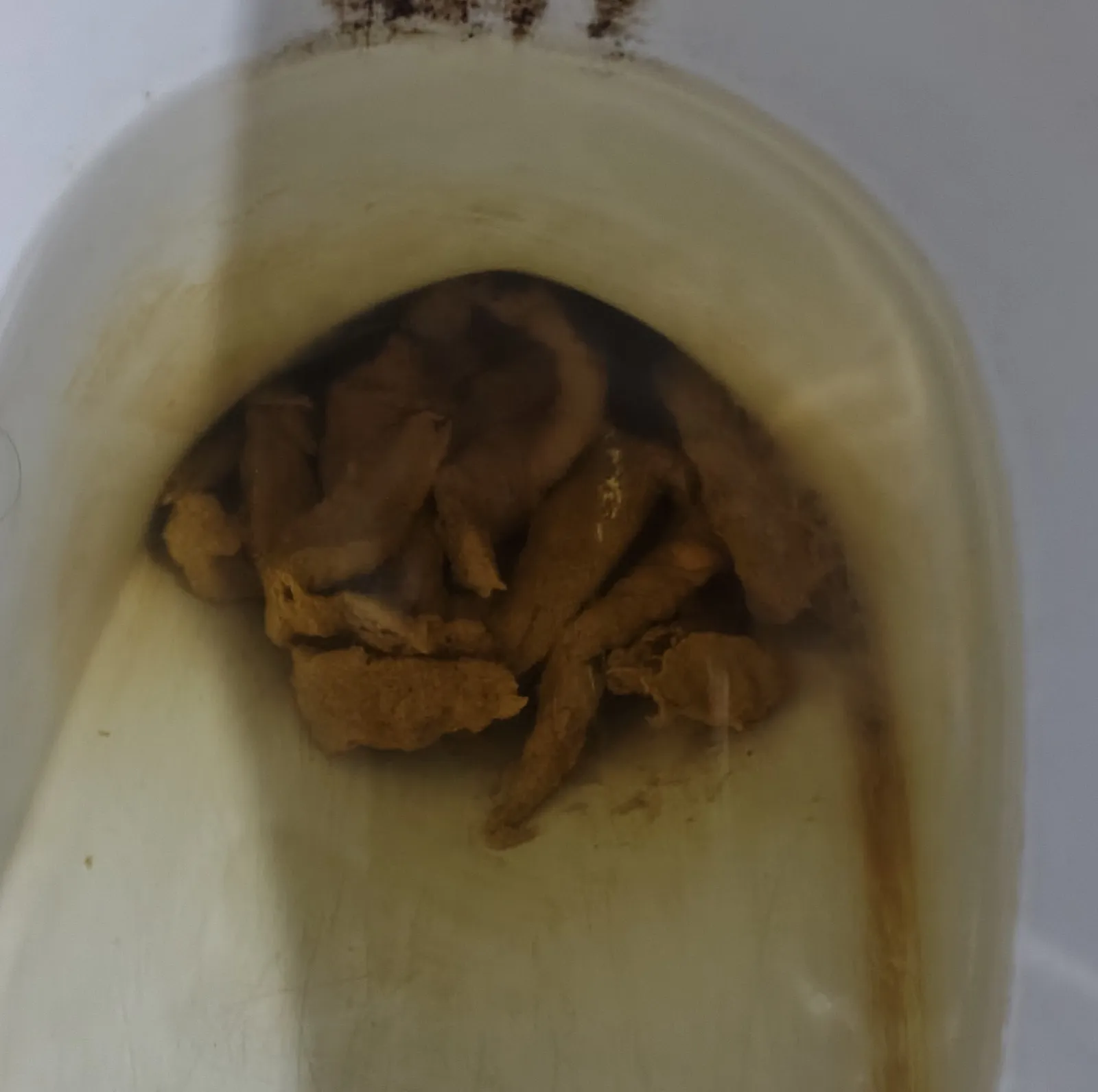 Scan my poop