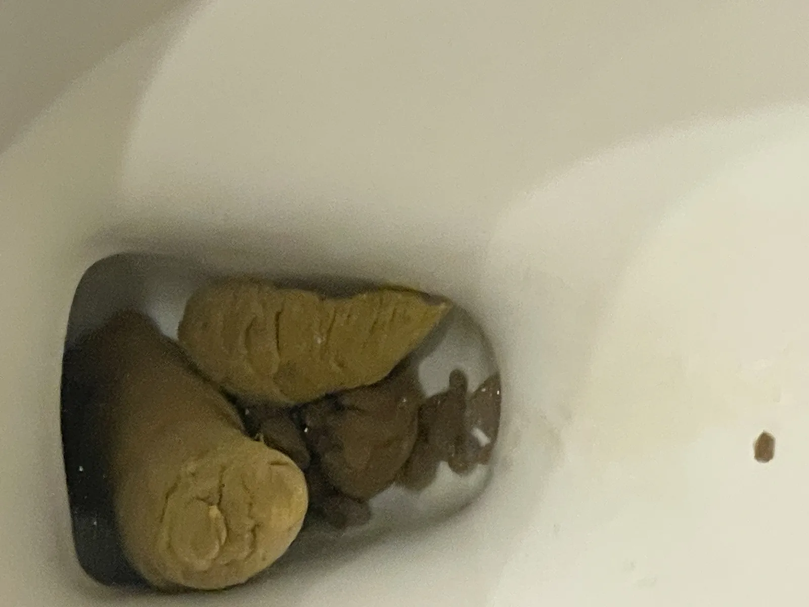 Massive shit