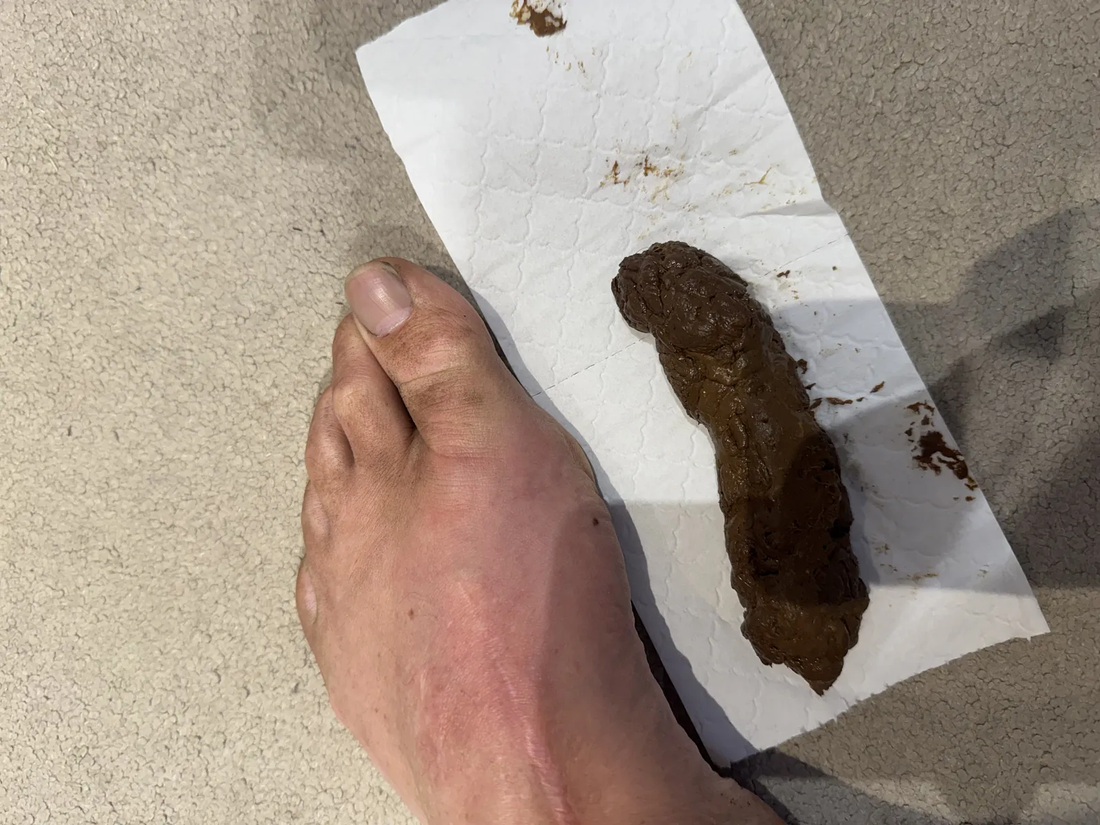 Foot Odor