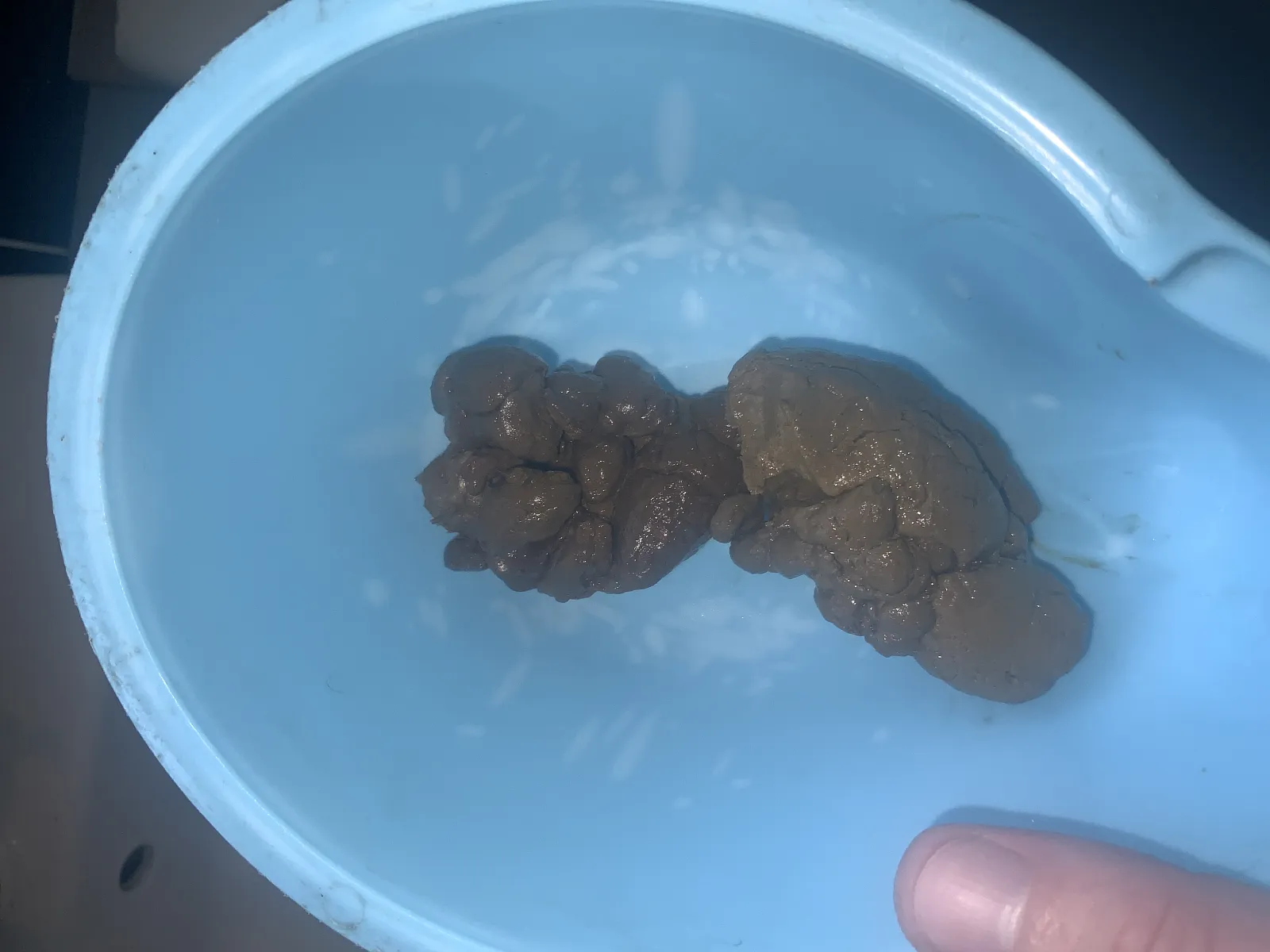Poop