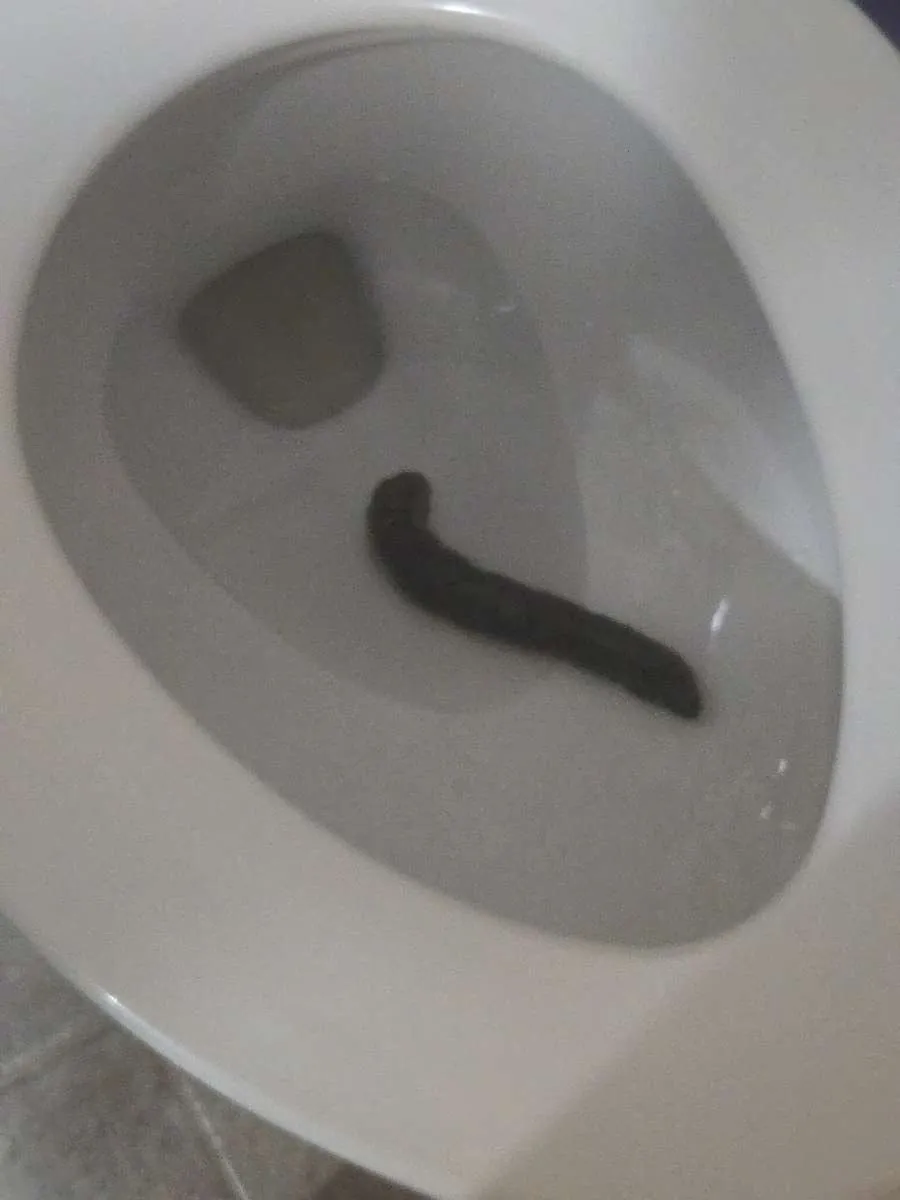 My poop