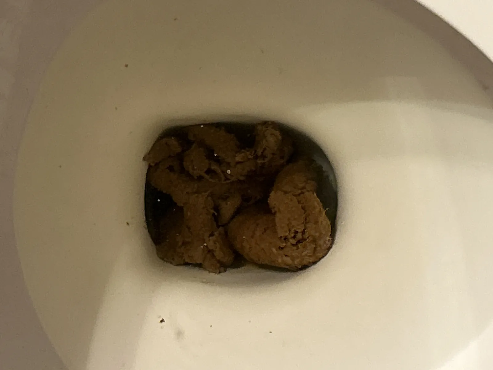 Diarrhea