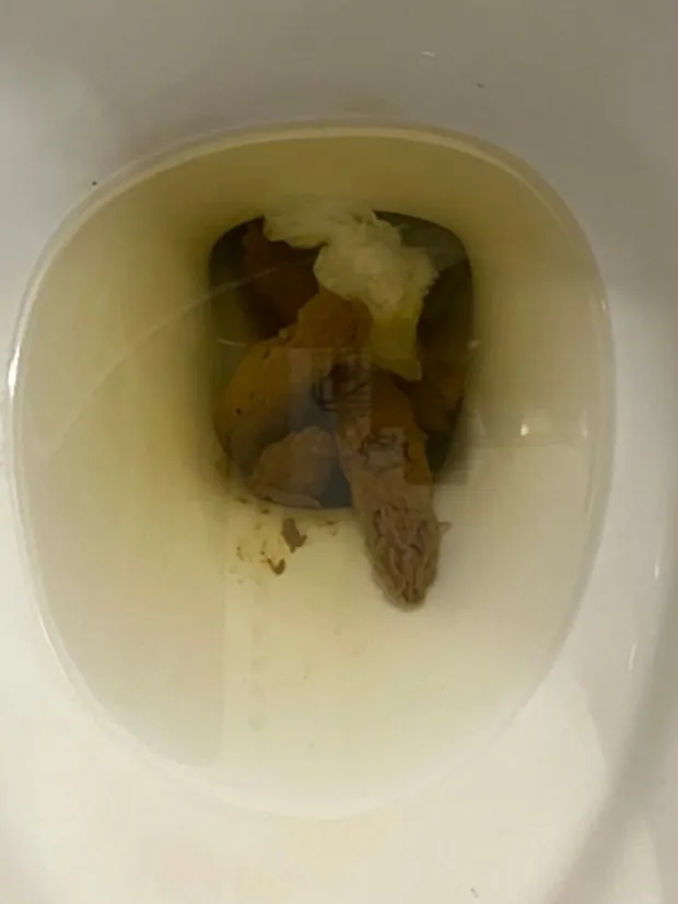 Ate too much, and it needed to come out