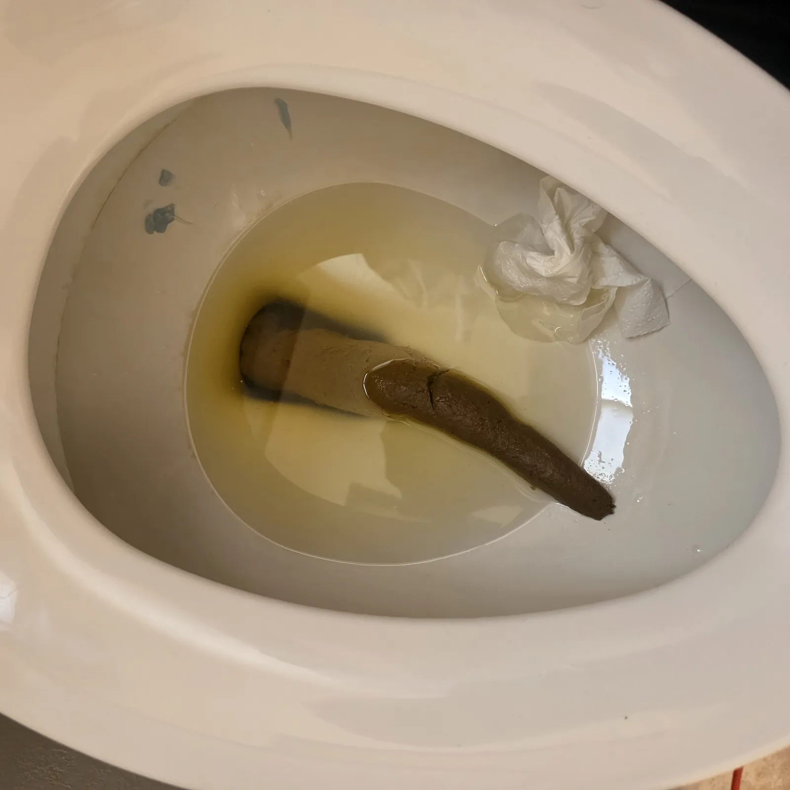 4 Days Constipated