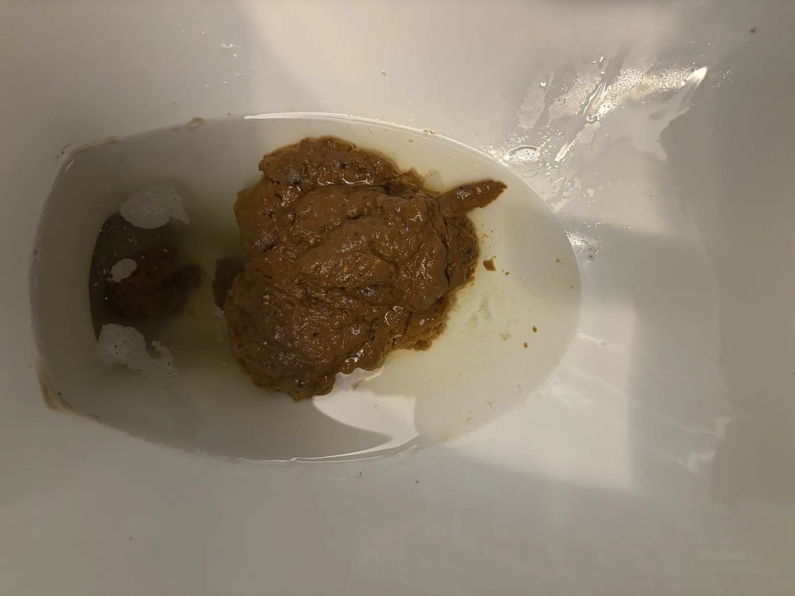 Brain stem