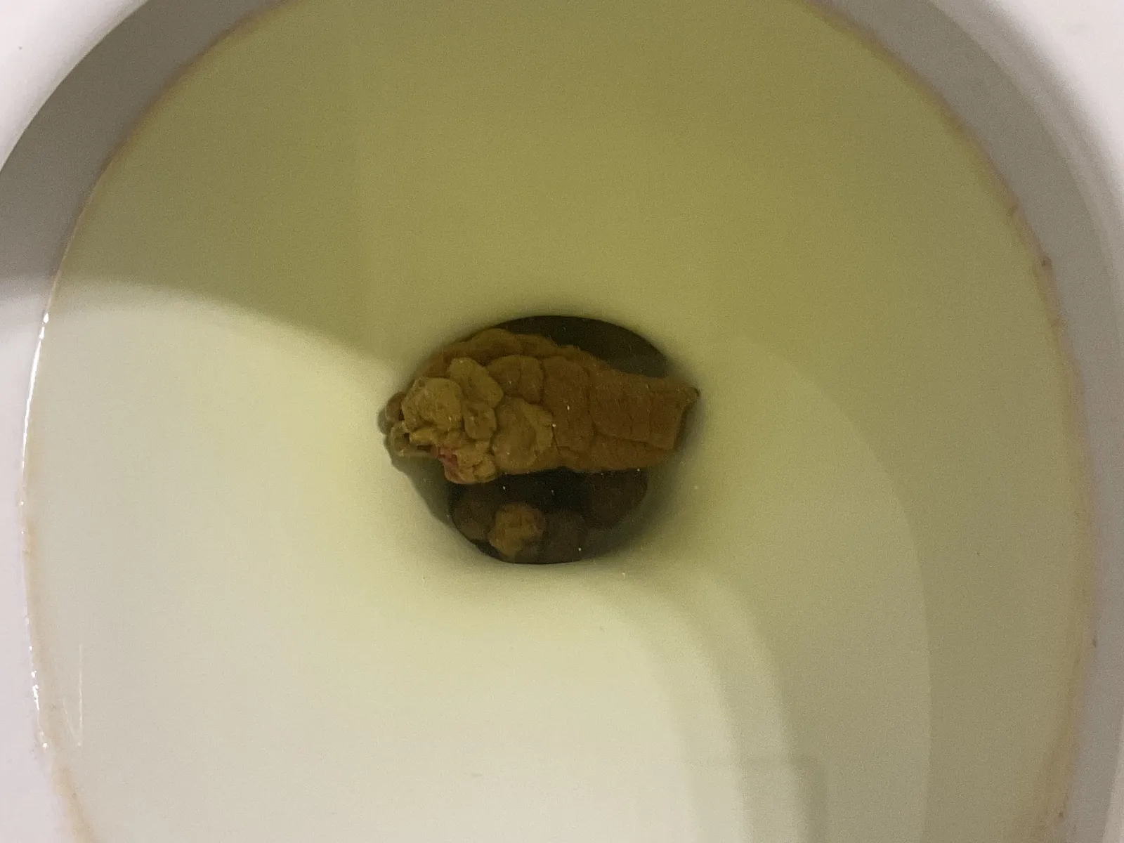 Lumpy poo