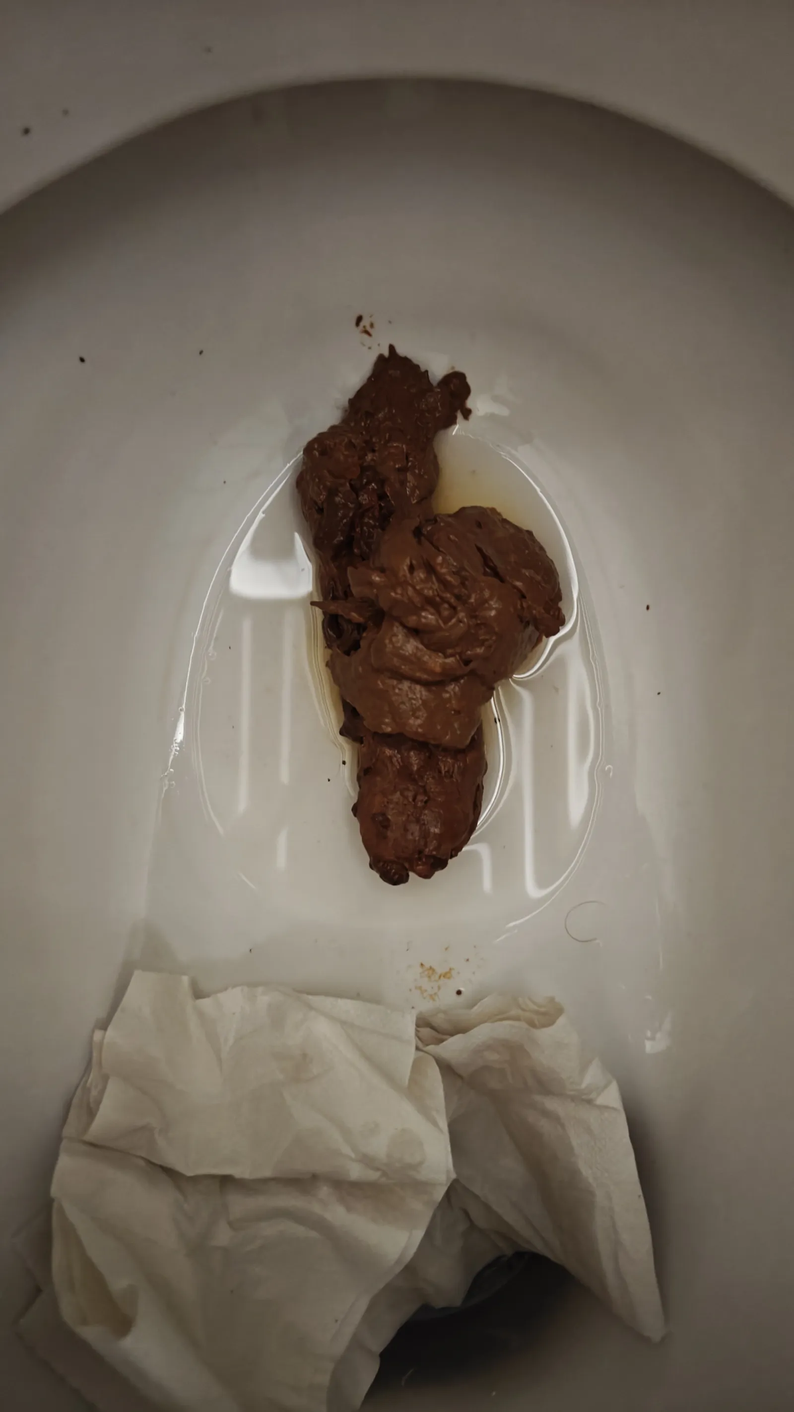 light and dark shit