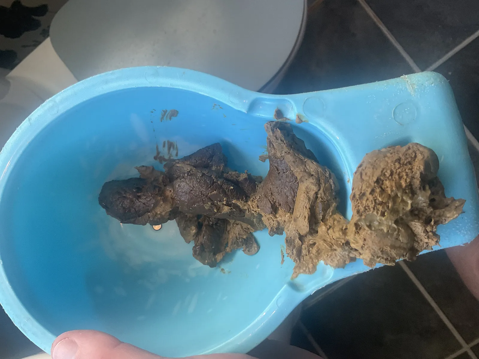 Poop dig