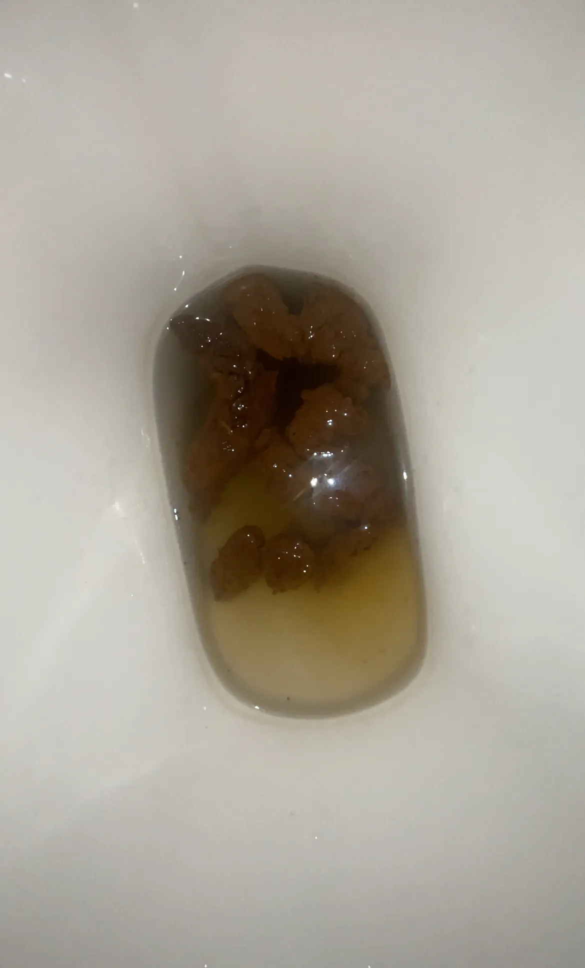Poop number 2