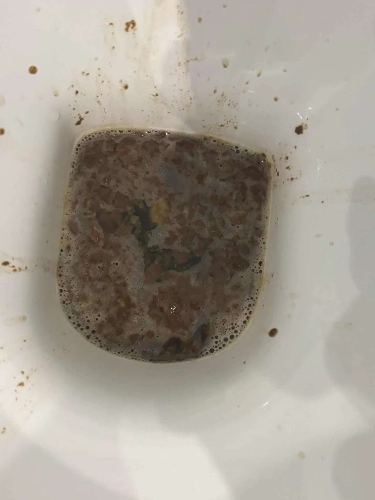 Ultra Shit