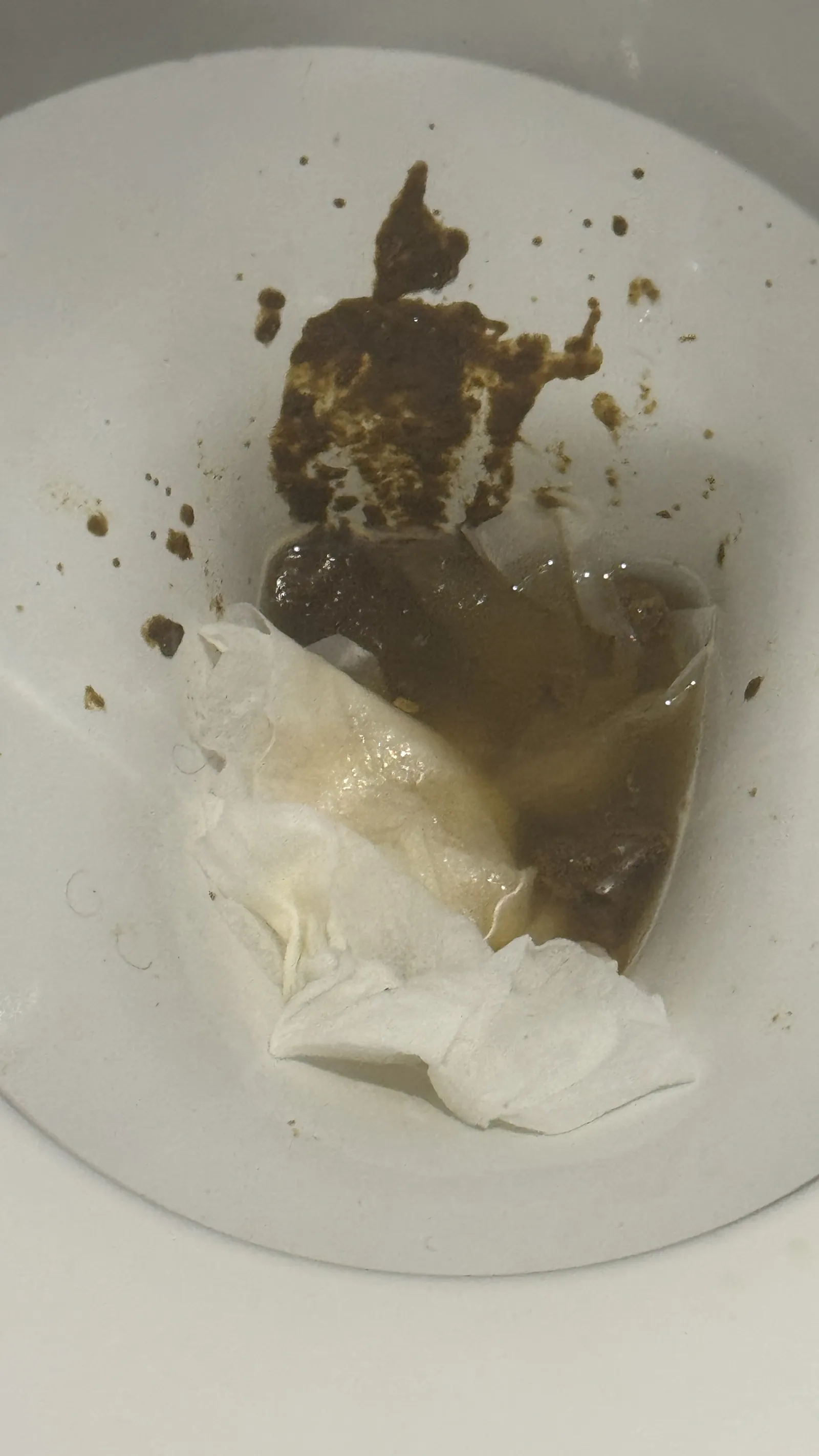 I got the shits