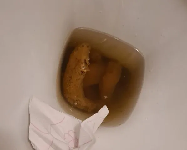 Smooth dump