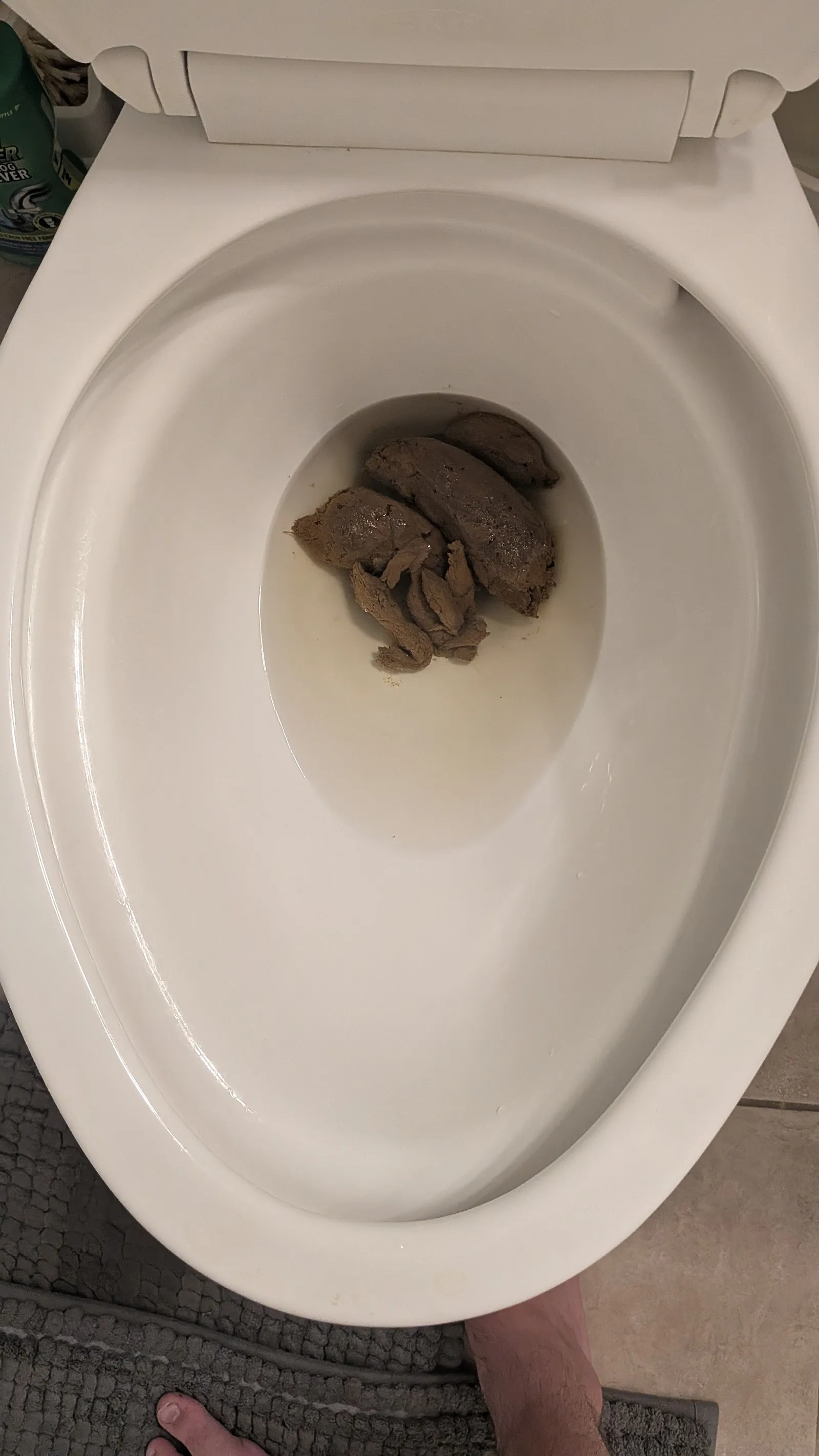 Constipated for a week