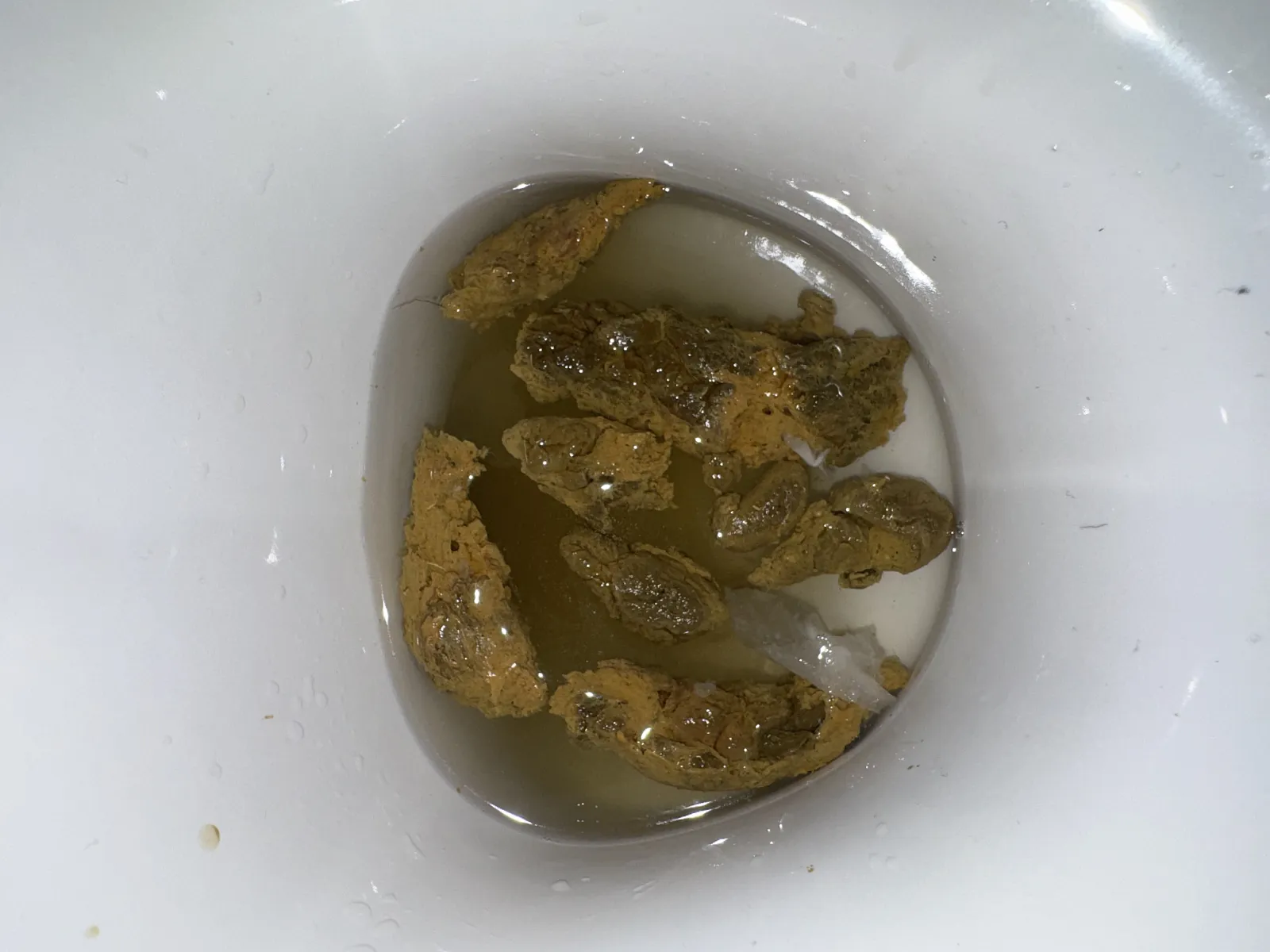 Poop
