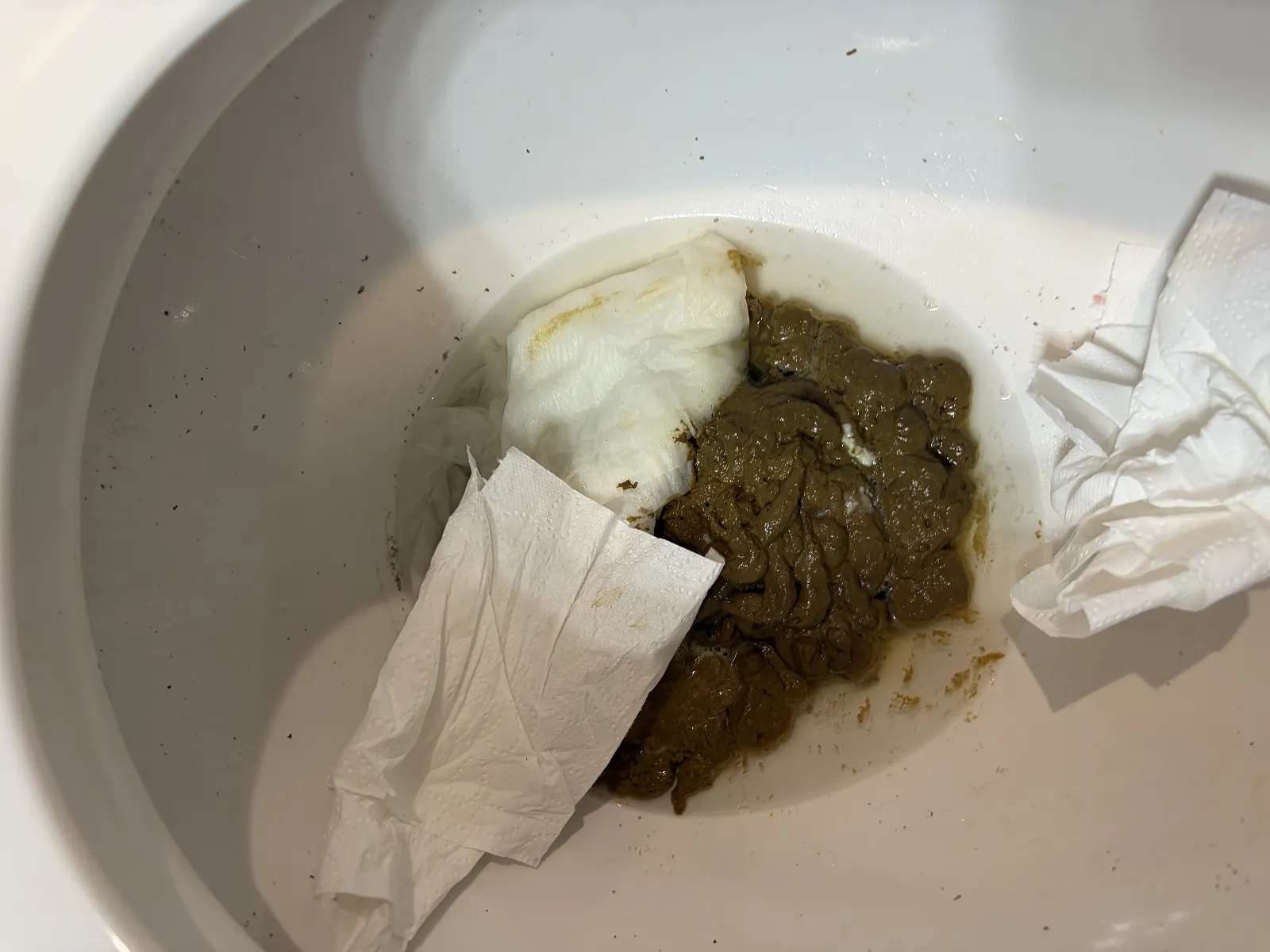 Mount shit
