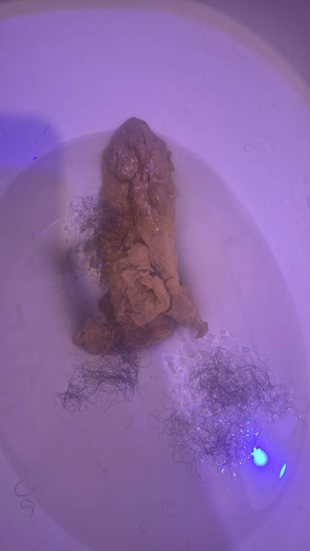 HAIRY POO