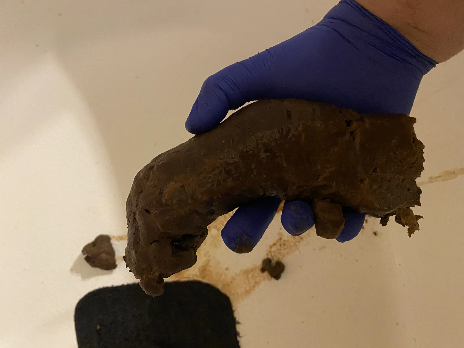 Postpartum Poo