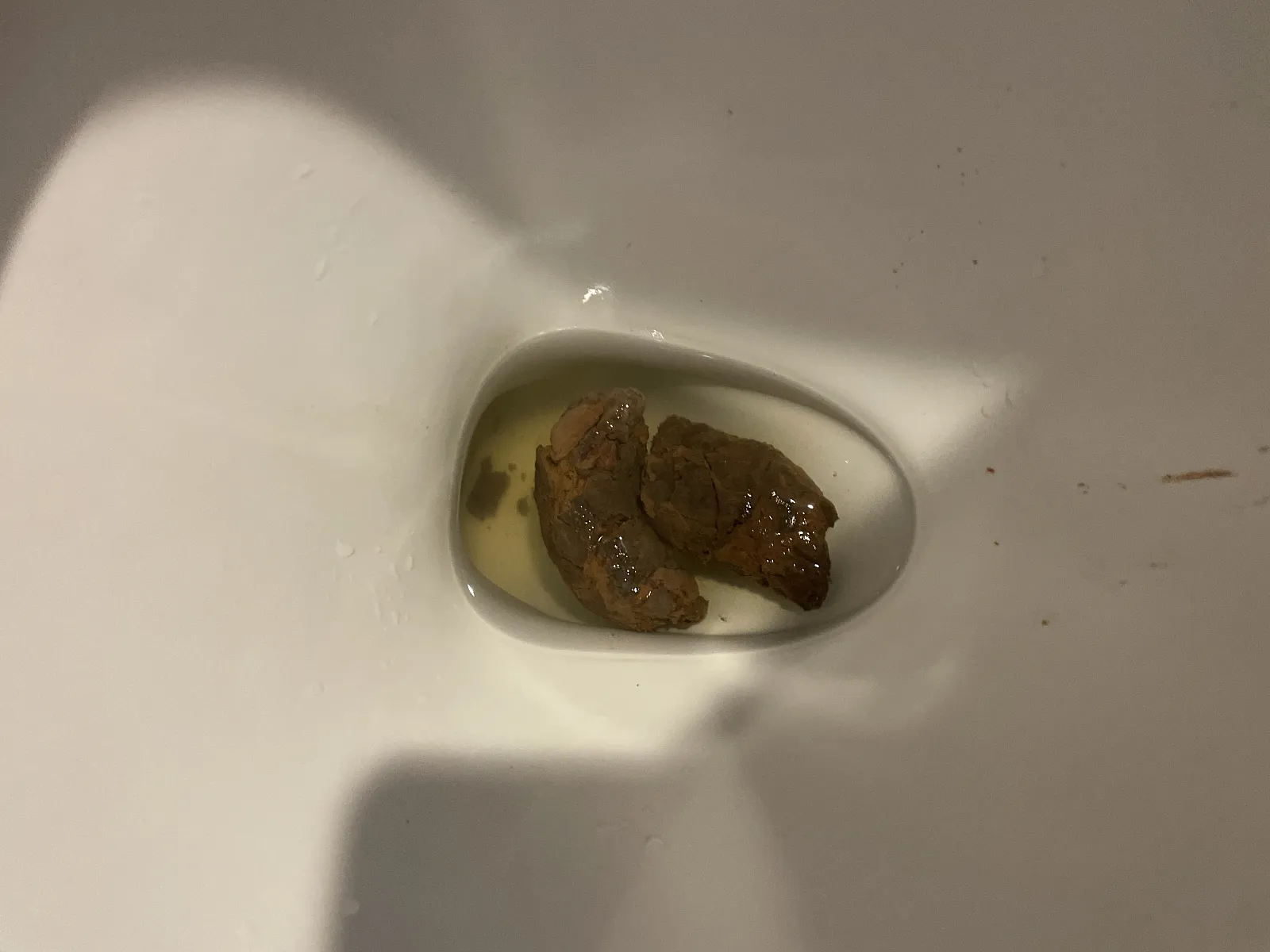 My poo