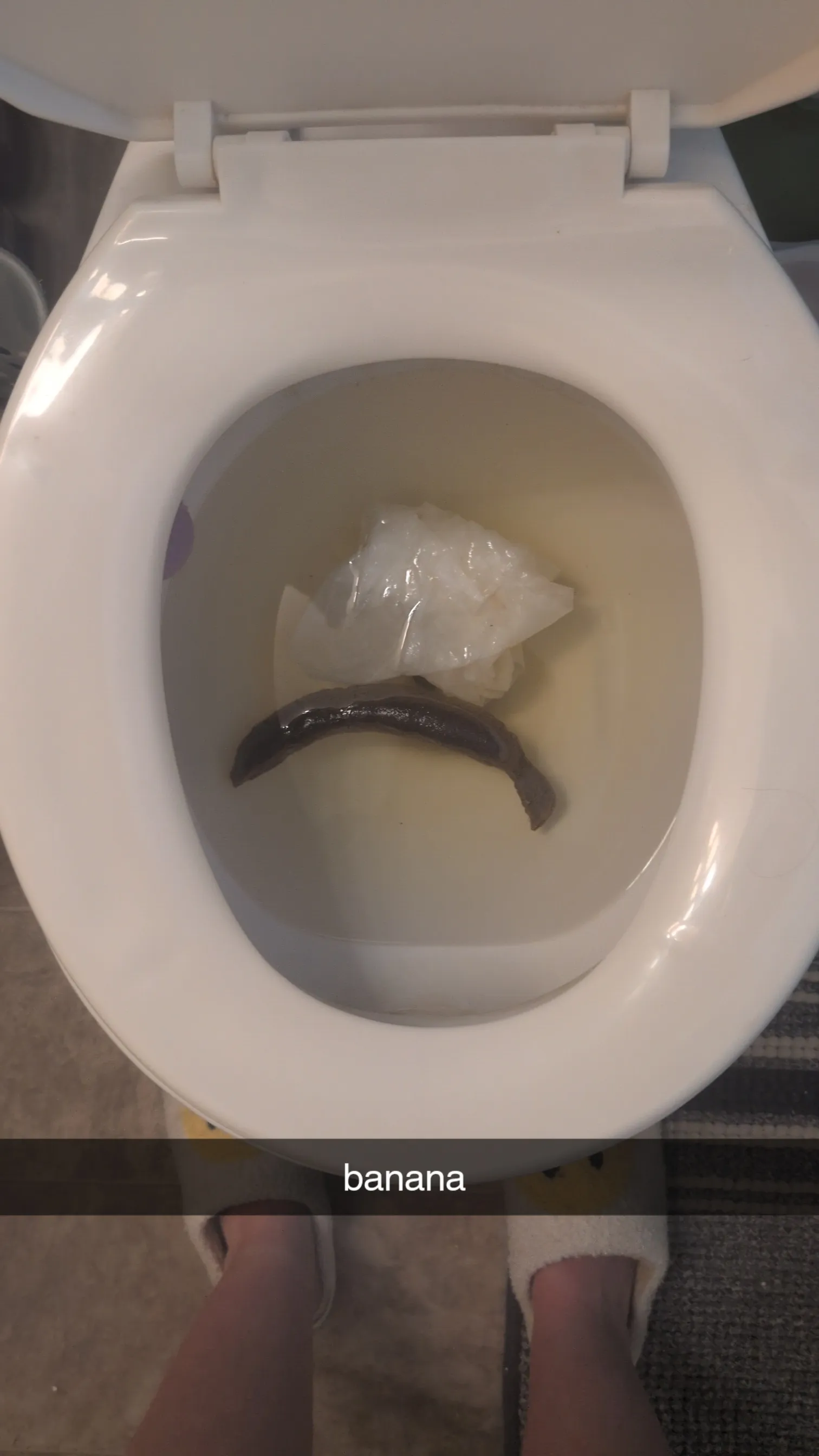 Banana Poop