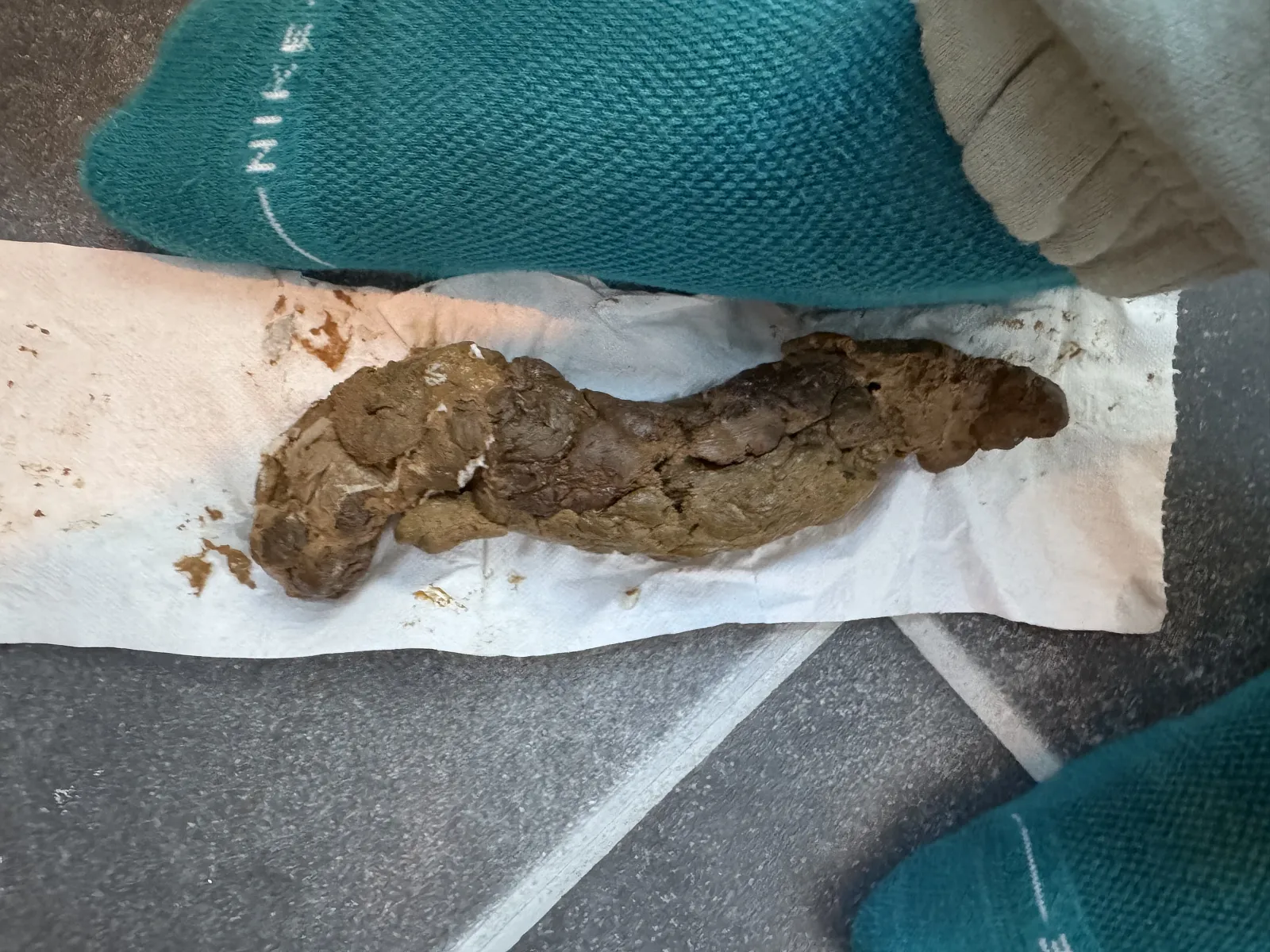 Poop big