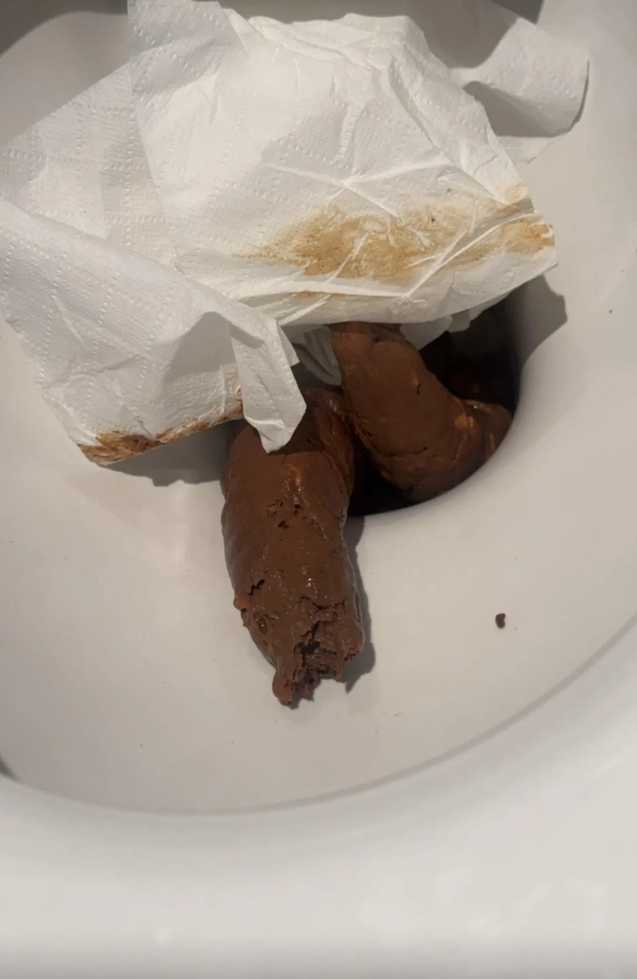 Poopendous