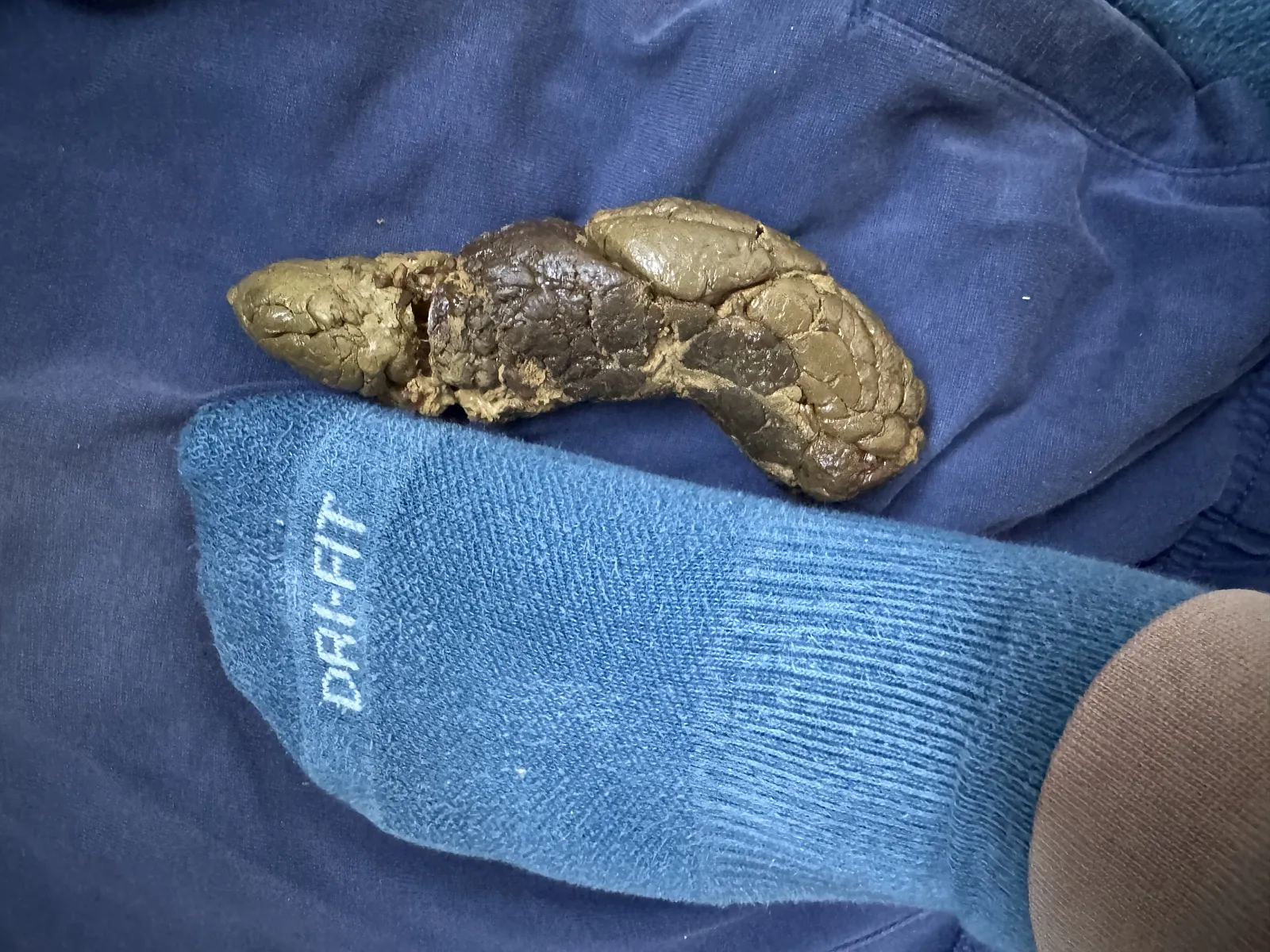 Poop