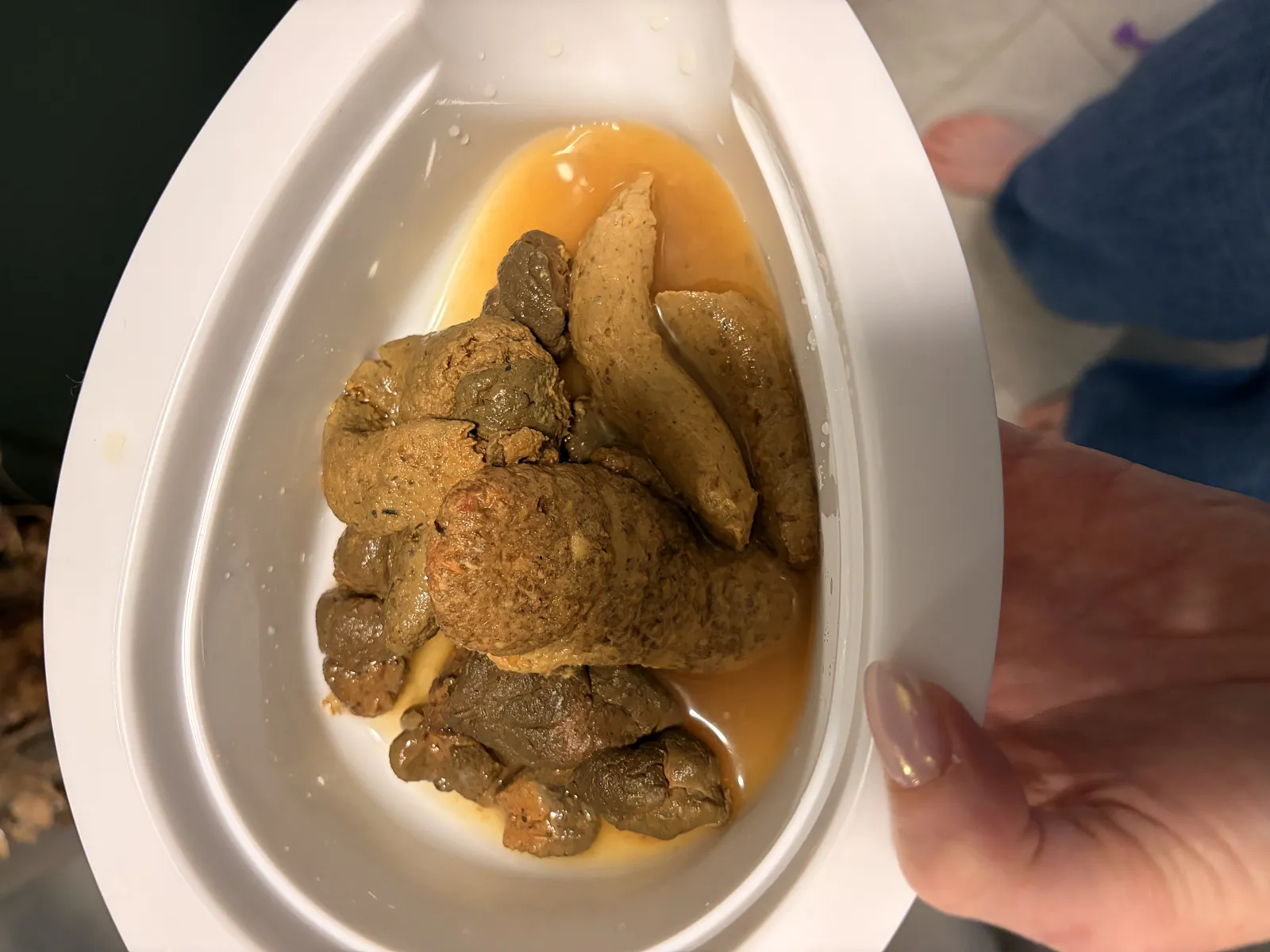 Insane toddler poo