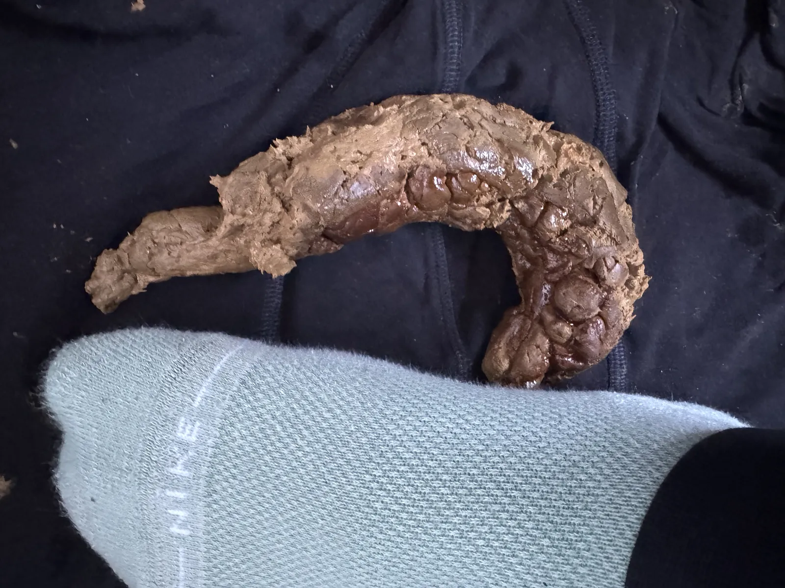 Poop