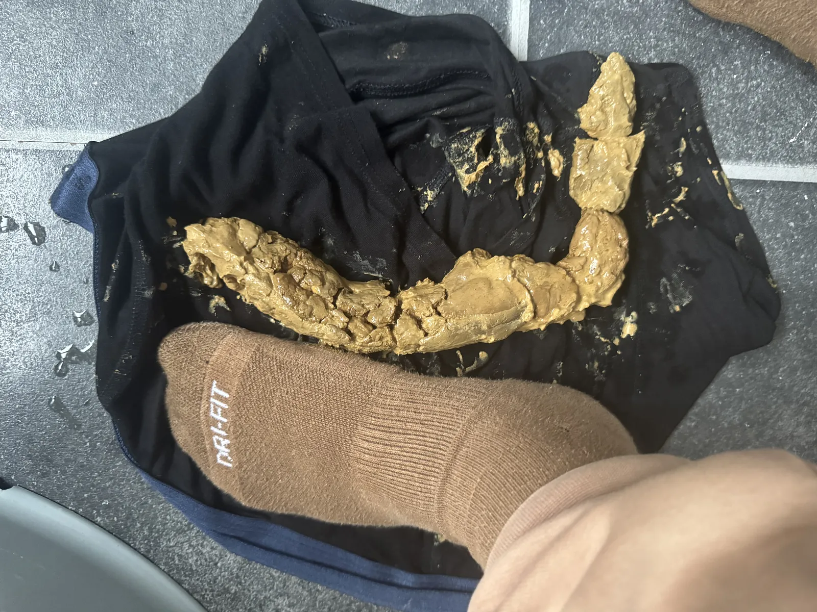 Poop