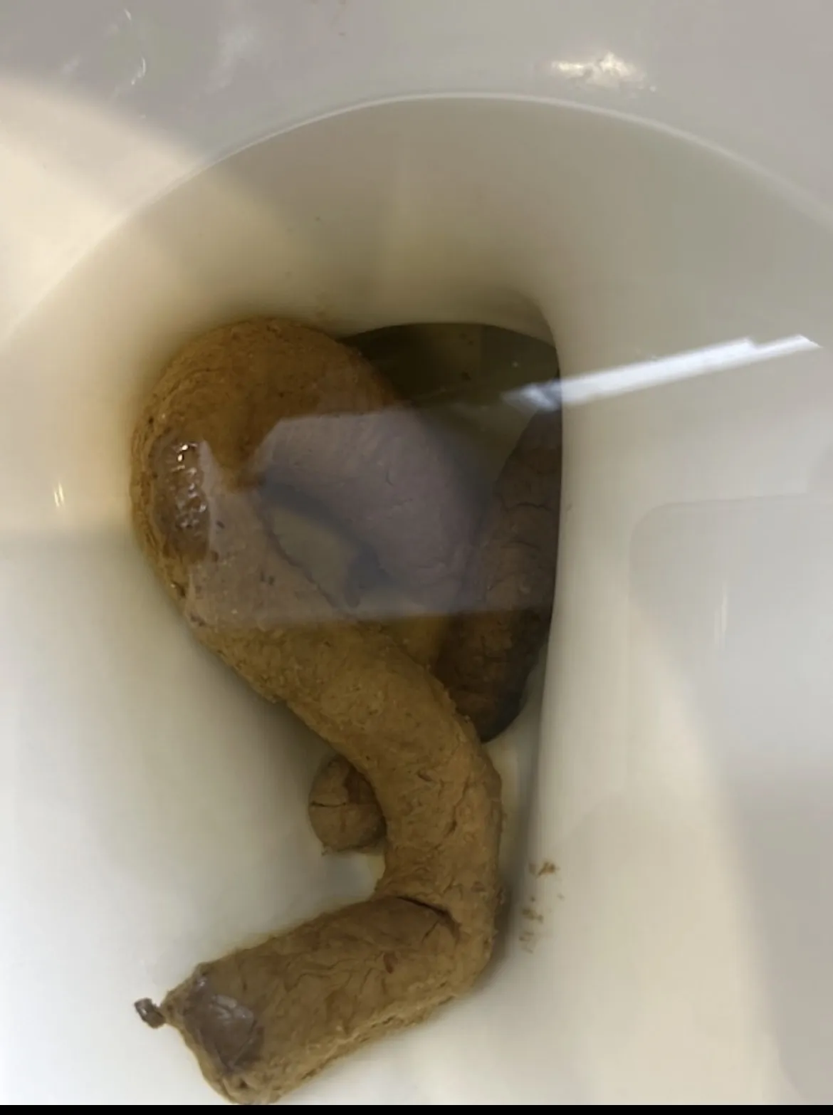 Anaconda