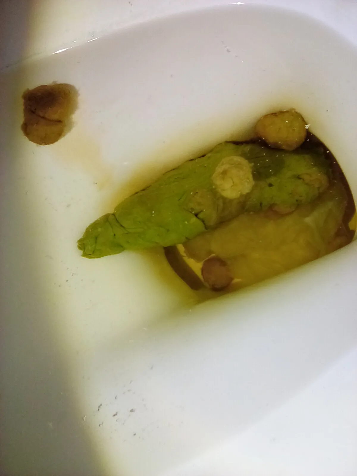 Green Poop