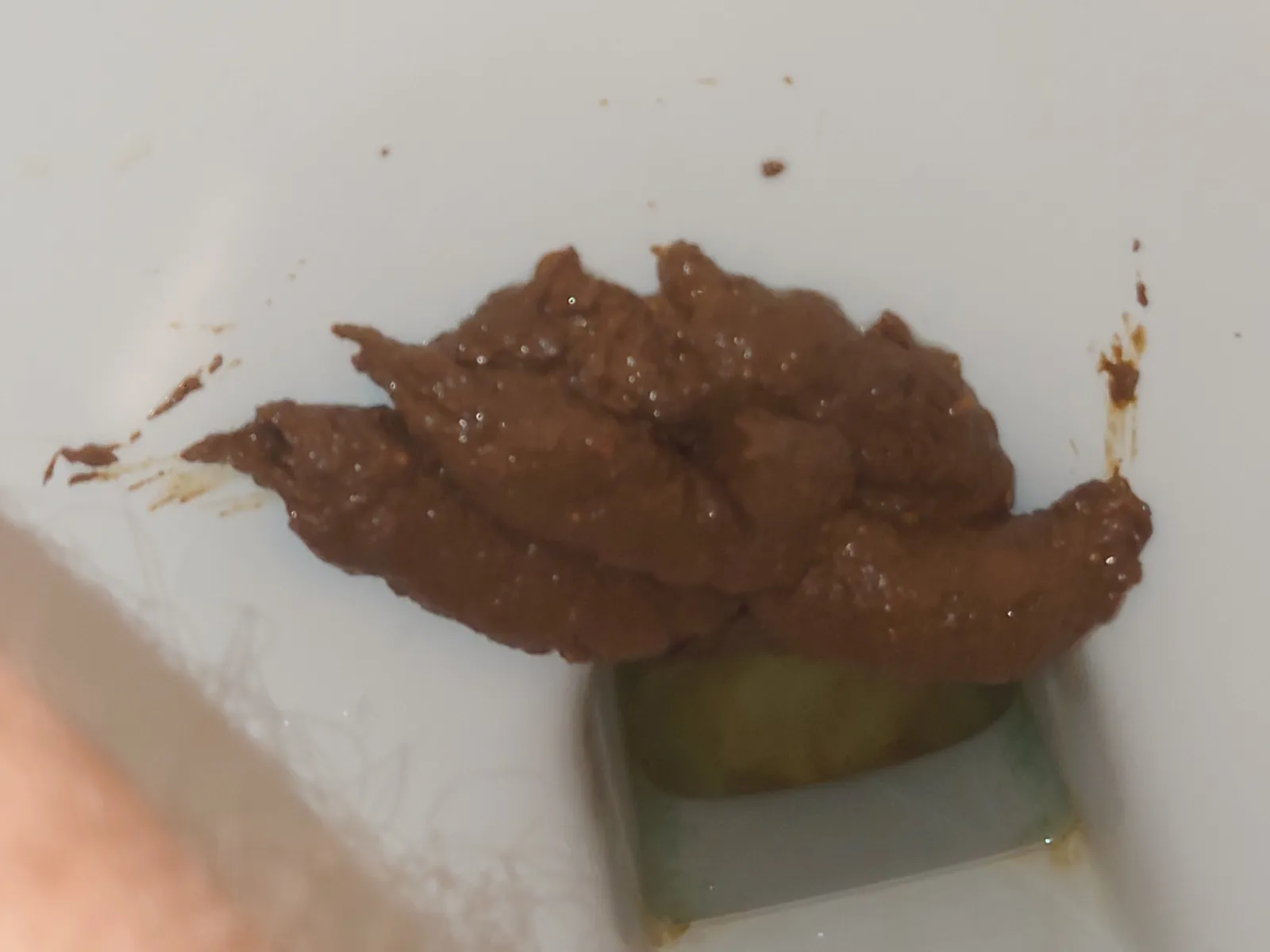 Mountain of turd